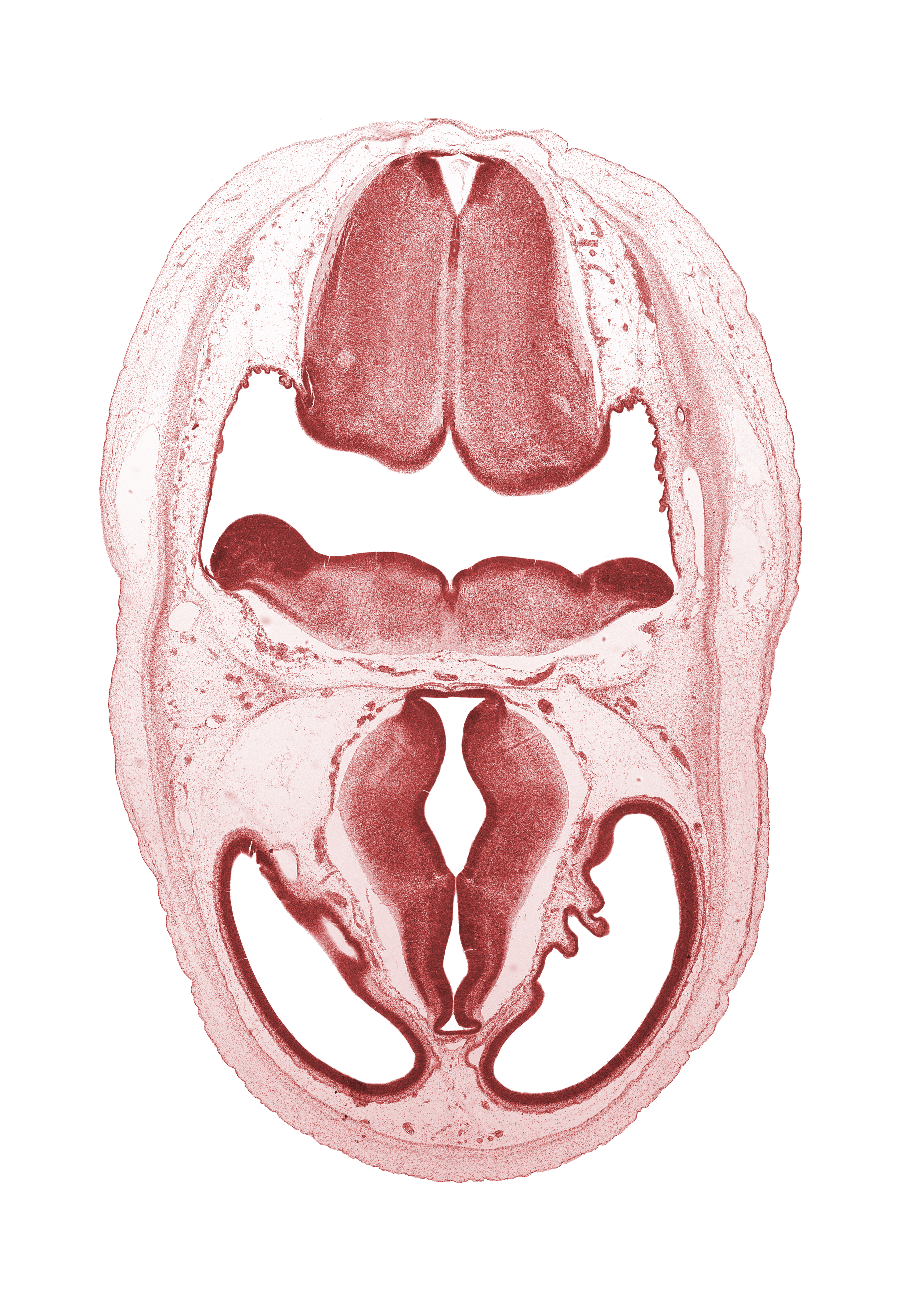 artifact separation(s), basilar artery, cerebral vesicle (telencephalon), dorsal thalamus, dural band for tentorium cerebelli, endolymphatic duct, hypothalamic sulcus, hypothalamus, intermediate zone, lateral ventricle, marginal zone, osteogenic layer, posterior communicating artery, subarachnoid space, third ventricle, ventral thalamus, ventricular zone, zona limitans intrathalamica