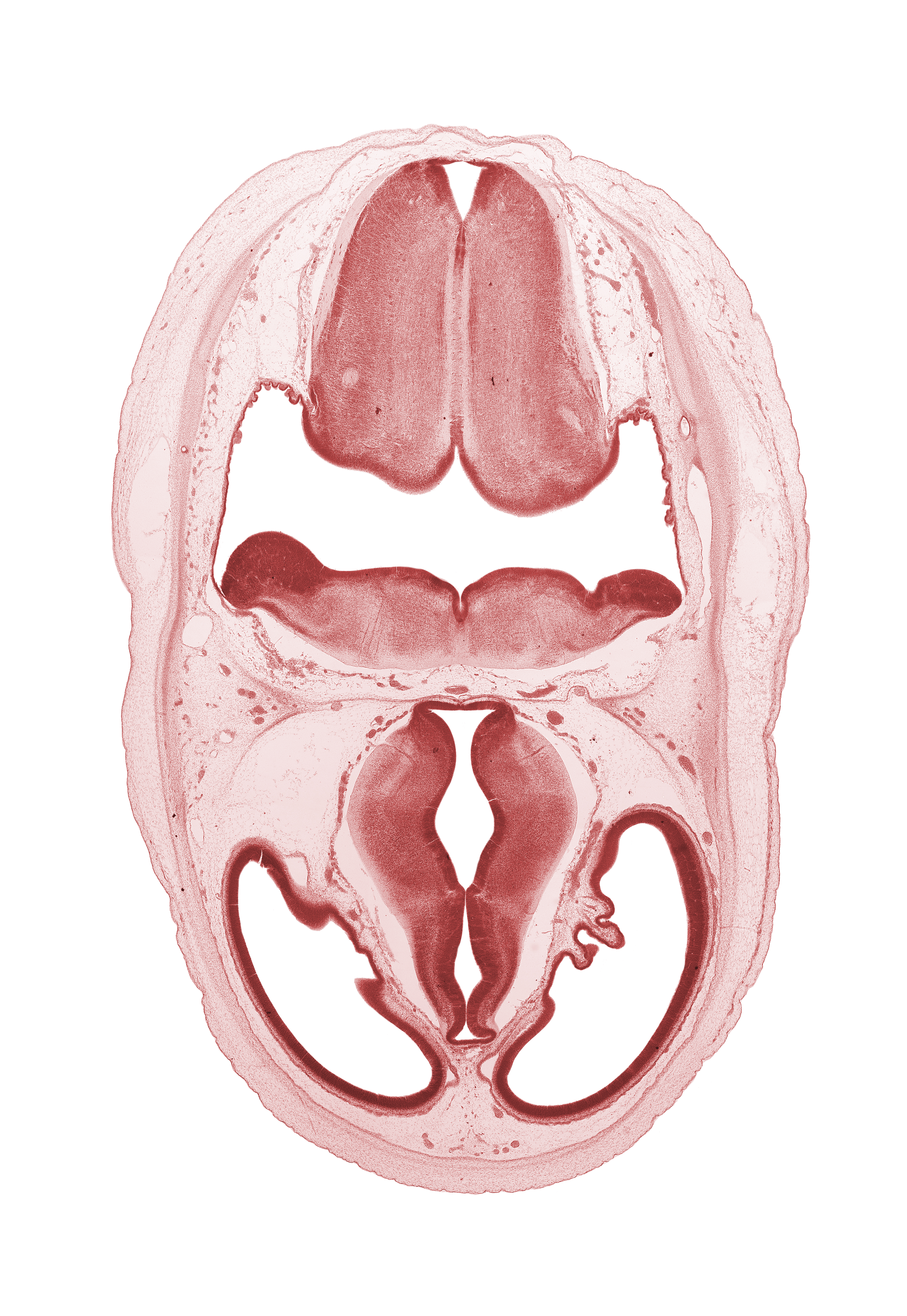 artifact separation(s), choroid plexus, dorsal thalamus, dural venous sinus, endolymphatic duct, loose connective tissue, marginal ridge, median sulcus, obex, oculomotor nerve (CN III), osteogenic layer, pons region (metencephalon), posterior communicating artery, sensory decussation, surface ectoderm, third ventricle, ventral thalamus
