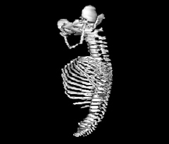 Axial Skeleton