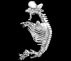 Skeleton