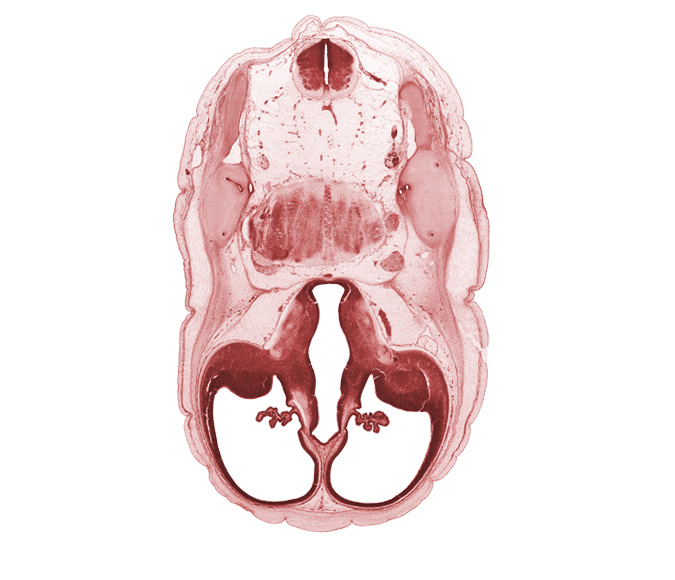 accessory nerve (CN XI), anterior semicircular duct, central canal, choroid plexus, common crus, decussation, dorsal thalamus, endolymphatic duct, facial nerve (CN VII), fiber tract, hypothalamic sulcus, hypothalamus, lateral ventricular eminence (telencephalon), pons region (metencephalon), posterior semicircular duct, roof plate of diencephalon, root of trigeminal nerve (CN V), vagus nerve (CN X), ventral thalamus, vestibulocochlear nerve (CN VIII)