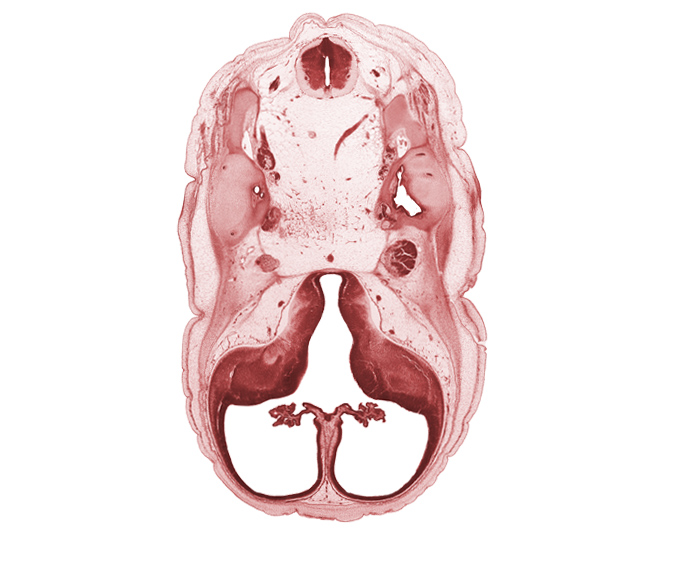 C-1 spinal ganglion, anterior semicircular duct, basilar artery, cerebral vesicle (hemisphere), common crus, facial nerve (CN VII), hippocampus, lateral semicircular duct, lateral ventricular eminence (telencephalon), medial ventricular eminence (diencephalon), posterior semicircular duct, trigeminal ganglion (CN V), utricle, vertebral artery