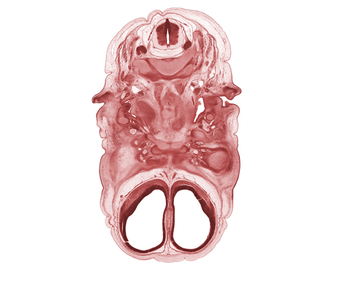 C-2 vertebra (axis), C-3 spinal ganglion, anterior cerebral artery, body of sphenoid, cerebral vesicle (hemisphere), external acoustic meatus, extrinsic ocular muscle(s), facial nerve (CN VII), inferior ganglion of glossopharyngeal nerve (CN IX), inferior ganglion of vagus nerve (CN X), internal carotid artery, lateral ventricle, osteogenic layer, pharyngeal arch 1 cartilage (Meckel), pharyngotympanic tube, stem of adenohypophysis, subarachnoid space