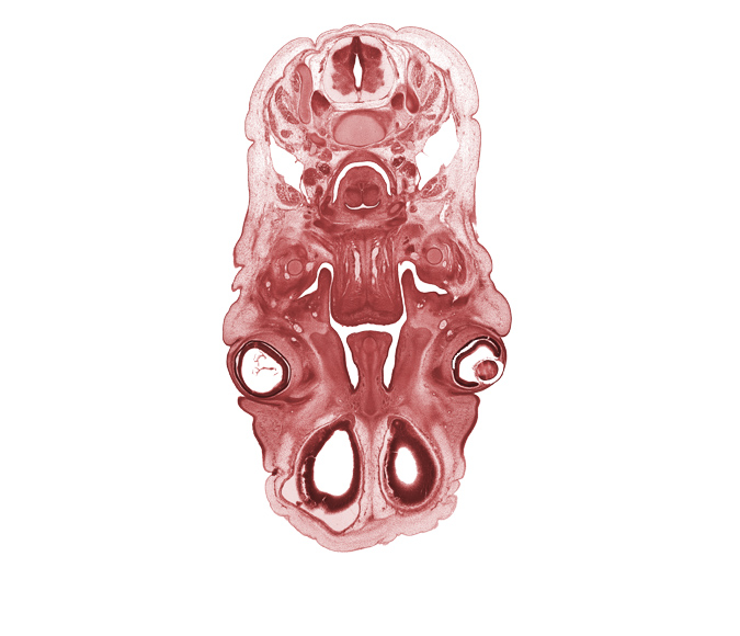 C-4 spinal ganglion, anterior scalene muscle, artifact fracture(s), cephalic edge of lateral ventricle, choana, cornea, head mesenchyme, hyaloid vessel(s), hypoglossal nerve (CN XII), intraretinal space (optic vesicle cavity), laryngeal pharynx, larynx, lens, masseter muscle, middle scalene muscle, nasal cavity (nasal sac), nasal septal cartilage, olfactory bulb, olfactory epithelium (placode), optic cup cavity, orbicularis oculi muscle, palatine shelf, platysma muscle, submandibular ganglion, surface ectoderm