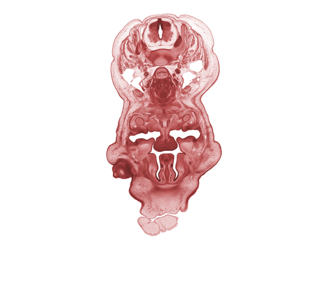 C-6 spinal ganglion, body of tongue, choana, edge of eyeball, edge of frontal prominence, esophagus endoderm, external jugular vein, head mesenchyme, infra-orbital nerve, internal jugular vein, interorbital ligament, jugular lymph sac, mandible, nasal capsule cartilage condensation, notochord, palatine shelf, pharyngeal arch 1 cartilage (Meckel), subarachnoid space, vomeronasal organ