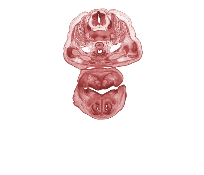 C-5 / C-6 intervertebral disc, C-6 spinal nerve, C-7 spinal ganglion, central canal, clavicle, esophagus, inferior parathyroid gland, intermediate zone, internal jugular vein, isthmus of thyroid gland, marginal zone, nasal capsule cartilage condensation, nasal cavity (nasal sac), nasal septal cartilage, oral cavity, oral fissure, pharyngeal arch 1 cartilage (Meckel), primary palate, vagus nerve (CN X), ventricular zone