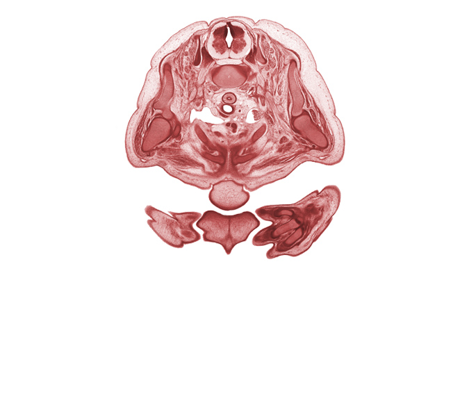 C-8 spinal ganglion, C-8 spinal nerve, chin, deltoid muscle, dorsal primary ramus, glenohumeral joint, head of humerus, hemisternum, left brachiocephalic vein, metacarpal 2, nose, scapula, spine of scapula, sympathetic trunk, trapezius muscle