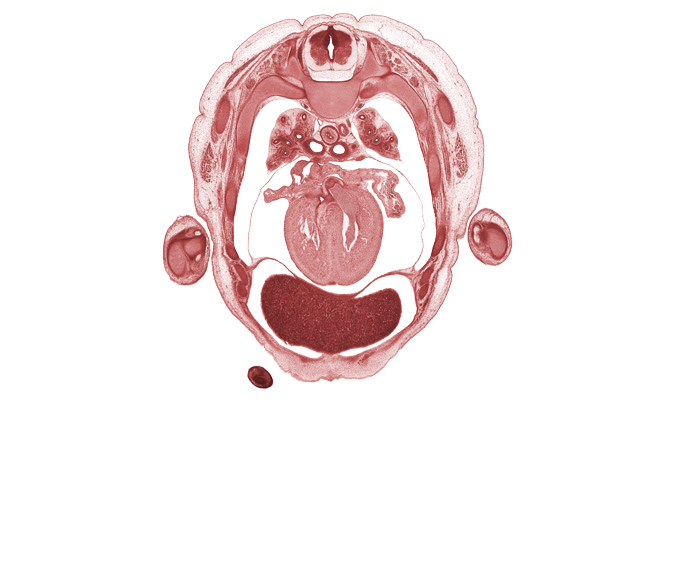 T-3 / T-4 interganglion region, aorta, auricle of left atrium, auricle of right atrium, azygos vein, digits (fingers), lower lobe of left lung, muscular part of interventricular septum, olecranon process of ulna, pericardial sac, pulmogenic coat, radius, rib 4, rib 5, rib 6, sinus venosus, subarachnoid space, sympathetic trunk, ulnar nerve, upper lobe of left lung