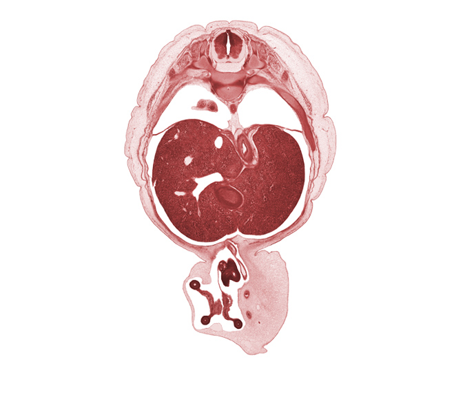 T-9 / T-10 intervertebral disc, T-9 spinal ganglion, T-9 spinal nerve, afferent hepatic vein, allantois, amnion on surface of umbilical cord, aorta, appendix, distal limb of herniated midgut, esophagus lumen, left lobe of liver, lesser sac (omental bursa), lower lobe of right lung, mediastinum, notochord, peritoneal cavity, proximal limb of herniated midgut, rib 10, right lobe of liver, surface ectoderm, umbilical coelom