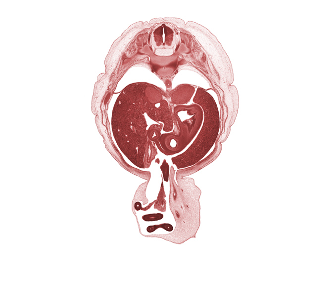 T-10 spinal ganglion, aorta, caudate lobe of liver, distal limb of herniated midgut, duodenum, gall bladder, head of rib 11, left umbilical artery, lesser curvature of stomach, lesser sac (omental bursa), mesentery, proximal limb of herniated midgut, pyloric antrum of stomach, right umbilical artery, sympathetic trunk