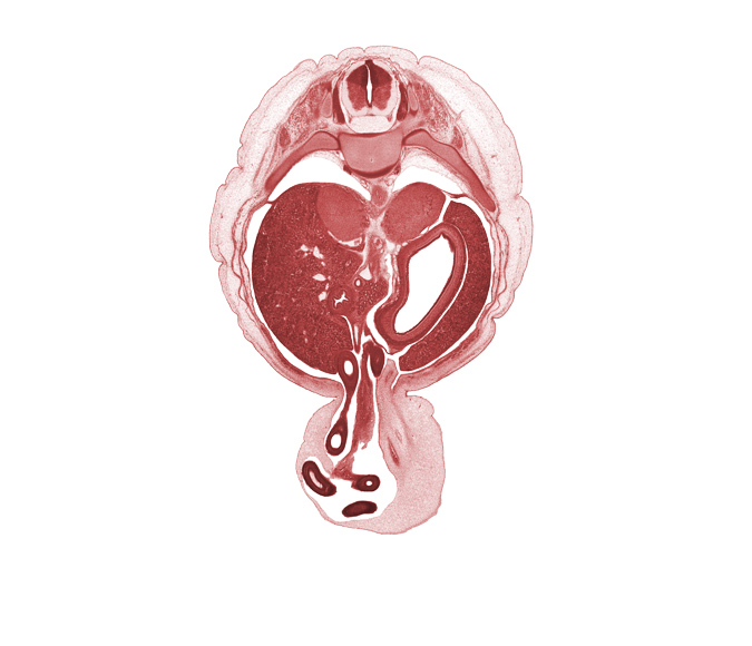 T-10 spinal ganglion, allantois, aorta, distal limb of midgut, duodenum, dura mater, head of ventral pancreas, junction of body and pyloric antrum of stomach, left lobe of liver, left umbilical artery, lesser sac (omental bursa), proximal limb of herniated midgut, rib 11, right umbilical artery, subarachnoid space, suprarenal gland cortex