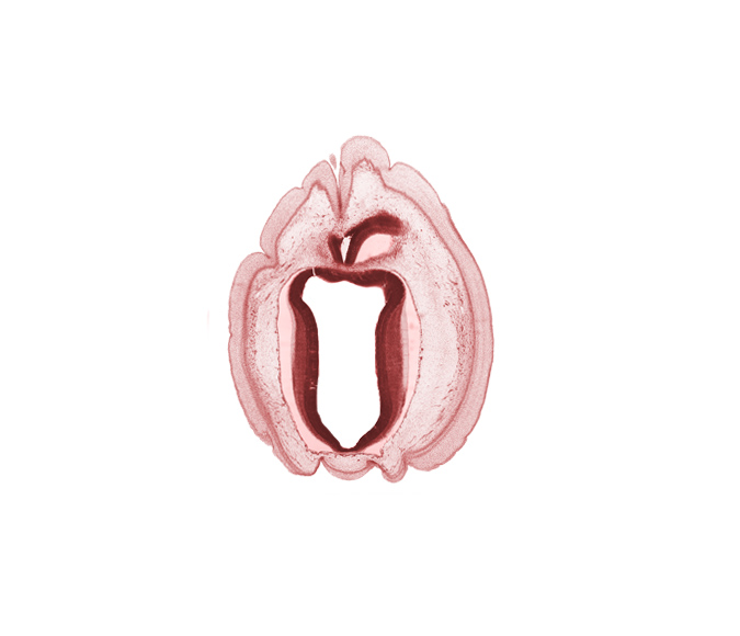 alar plate of mesencephalon, edge of rhombencoel (fourth ventricle), intermediate zone, marginal zone, roof plate of mesencephalon, ventricular zone