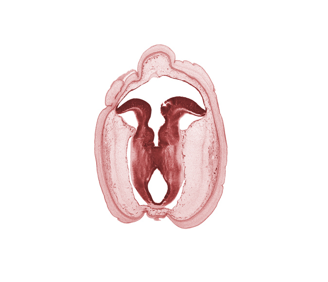 alar plate of mesencephalon, alar plate of metencephalon (cerebellum), basal plate of mesencephalon, basal plate of metencephalon, cerebral aqueduct (mesocoele), commissure in roof plate of mesencephalon, fiber tract, floor plate, isthmus of rhombencephalon, osteogenic layer, rhombencoel (fourth ventricle), subarachnoid space, sulcus limitans, trochlear nerve (CN IV), vascular plexus