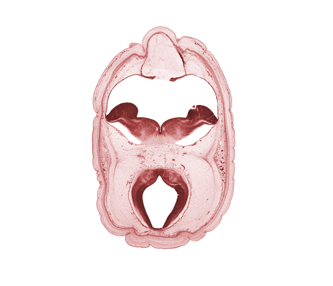 alar plate(s), artifact space(s), basal plate, dural band for tentorium cerebelli, floor plate of mesencephalon, oculomotor nerve (CN III), roof plate of mesencephalon, subarachnoid space, sulcus limitans, superficial vascular plexus, tectum of mesencephalon, tegmentum of mesencephalon, trochlear nerve (CN IV)