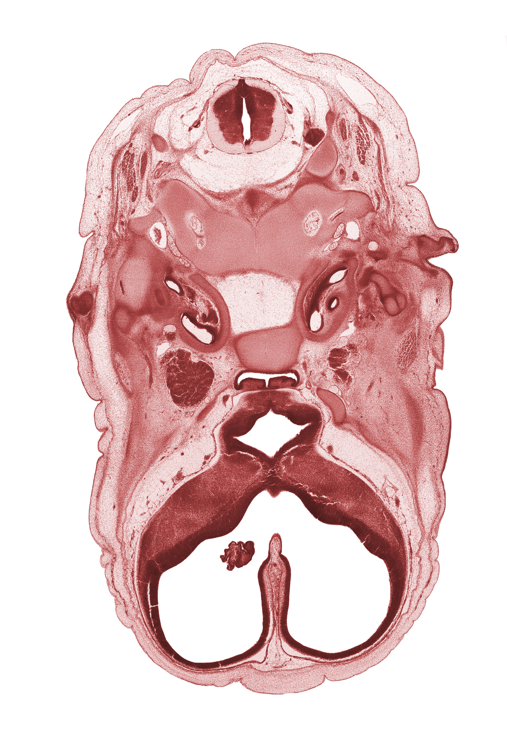 C-2 spinal ganglion, atlanto-occipital joint, auricular cartilage condensation, cephalic edge of auricle, cochlear duct, cranial cavity, facial nerve (CN VII), hypoglossal canal, intermediate zone, internal carotid artery, lateral ventricular eminence (telencephalon), lumen of adenohypophysis, marginal zone, medial ventricular eminence (diencephalon), ophthalmic nerve (CN V₁), optic groove, spinal accessory nerve (CN XI), third ventricle, tip of cochlear duct, vascular plexus, ventricular zone