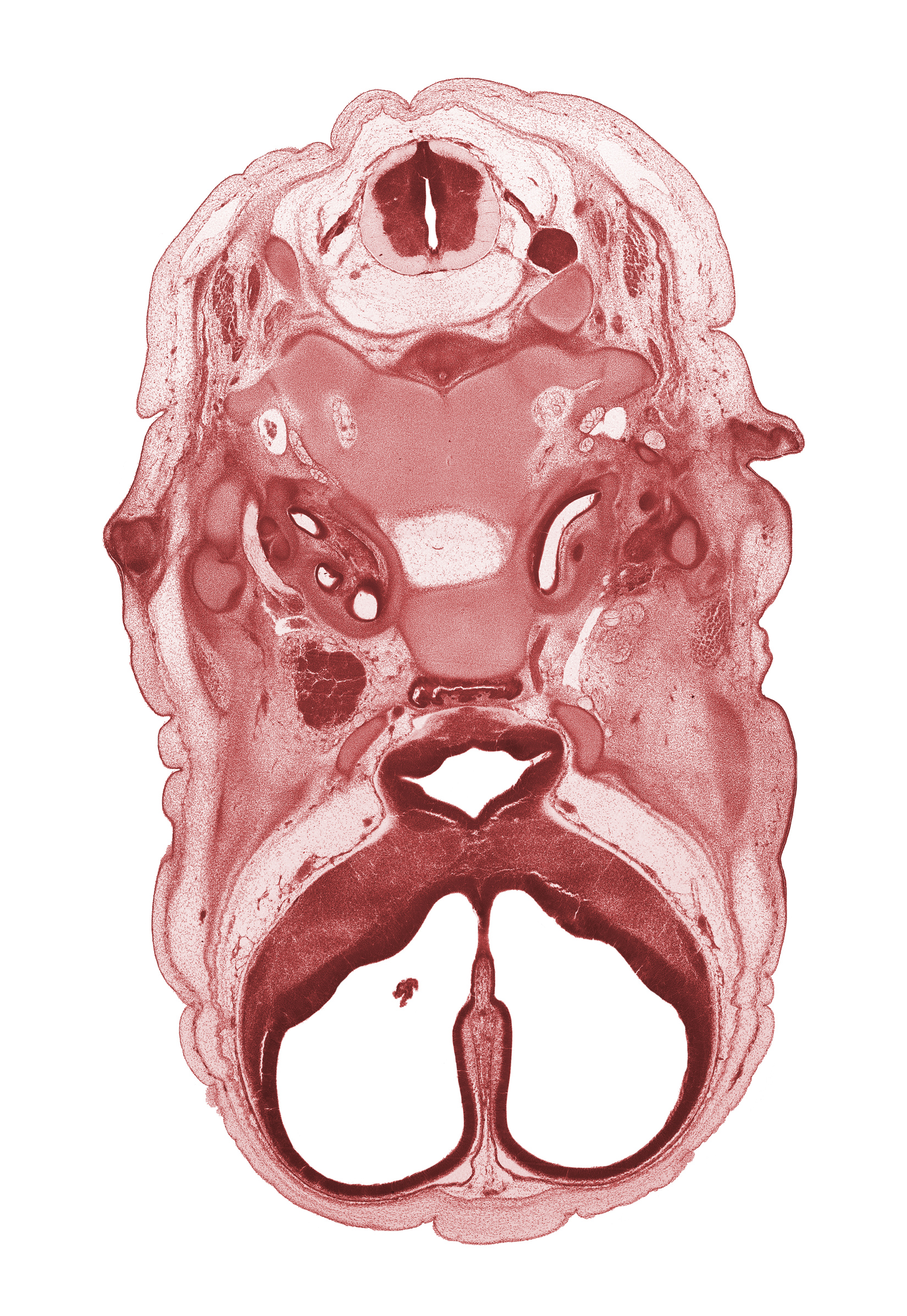 C-2 dorsal root, C-2 spinal ganglion, accessory nerve (CN XI), adenohypophysis, atlanto-occipital joint, auricle, body of sphenoid, cerebral vesicle (hemisphere), cochlear duct, edge of choroid plexus, falx cerebri region, geniculate ganglion (CN VII), glossopharyngeal nerve (CN IX), head mesenchyme, horizontal part of facial nerve (CN VII), internal carotid artery, junction of internal carotid and posterior communicating arteries, lateral ventricle, neural arch of C-1 vertebra (atlas), notochord, optic chiasma (chiasmatic plate), orbitosphenoid, osteogenic layer, sulcus limitans, surface ectoderm, temporalis muscle, vagus nerve (CN X), venous plexus(es)