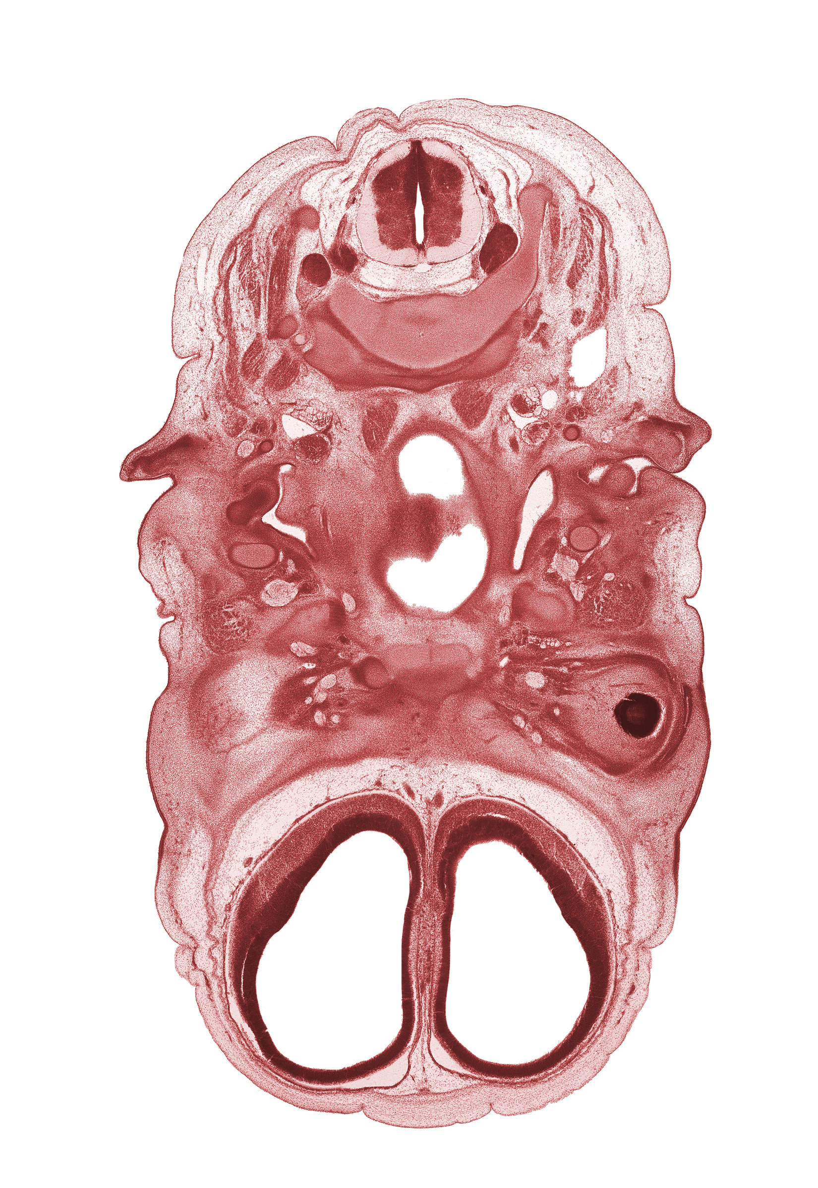 C-3 spinal ganglion, anterior cerebral artery, artifact space(s), auricle, body of sphenoid, cephalic edge of pharynx, dura mater, ear ossicle condensation, edge of pigmented layer of retina, extrinsic ocular muscle(s), grey matter, internal carotid artery, pharyngeal arch 1 cartilage (Meckel), pharyngeal arch 2 cartilage, pharyngotympanic tube, subarachnoid space, sympathetic trunk, vagus nerve (CN X), vascular plexus, venous plexus (superior sagittal sinus region), white matter