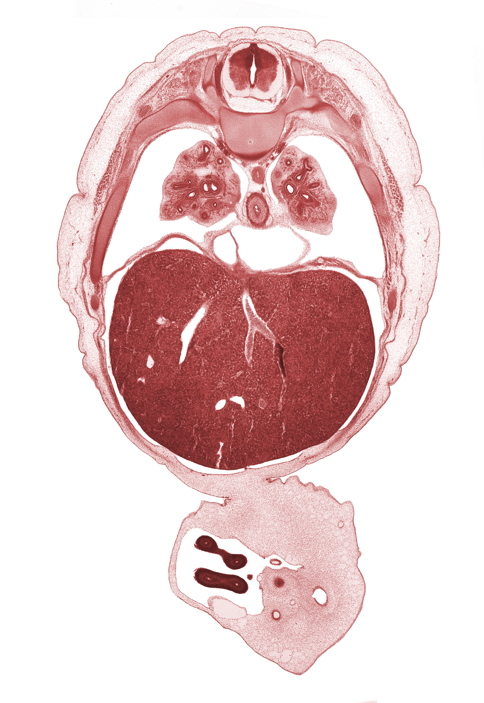 T-6 / T-7 interganglion region, aorta, artifact fracture(s), cyst, distal limb of herniated midgut, external abdominal oblique muscle, inferior vena cava, lower lobe of right lung, notochord, pericardial cavity, pericardial sac, proximal limb of herniated midgut, rib 8, rib 9, sympathetic trunk, umbilical cord