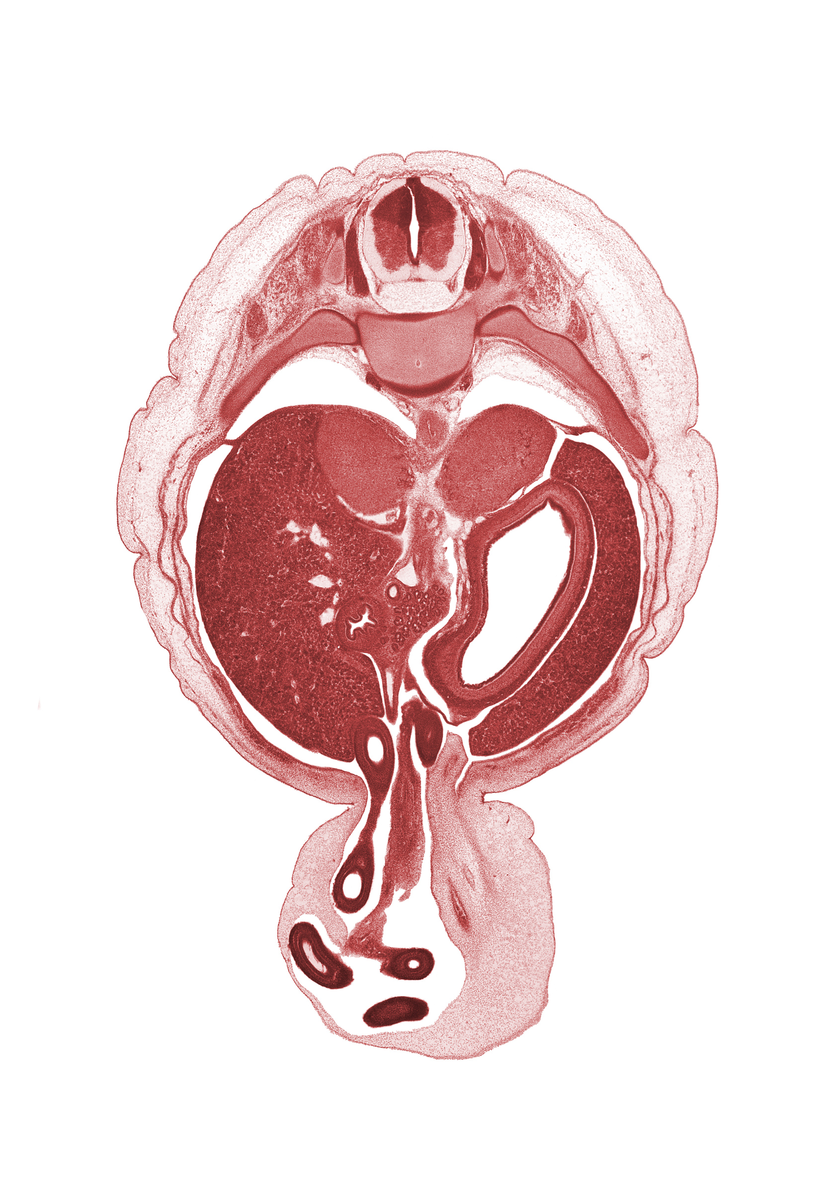 T-10 spinal ganglion, allantois, aorta, distal limb of midgut, duodenum, dura mater, head of ventral pancreas, junction of body and pyloric antrum of stomach, left lobe of liver, left umbilical artery, lesser sac (omental bursa), proximal limb of herniated midgut, rib 11, right umbilical artery, subarachnoid space, suprarenal gland cortex