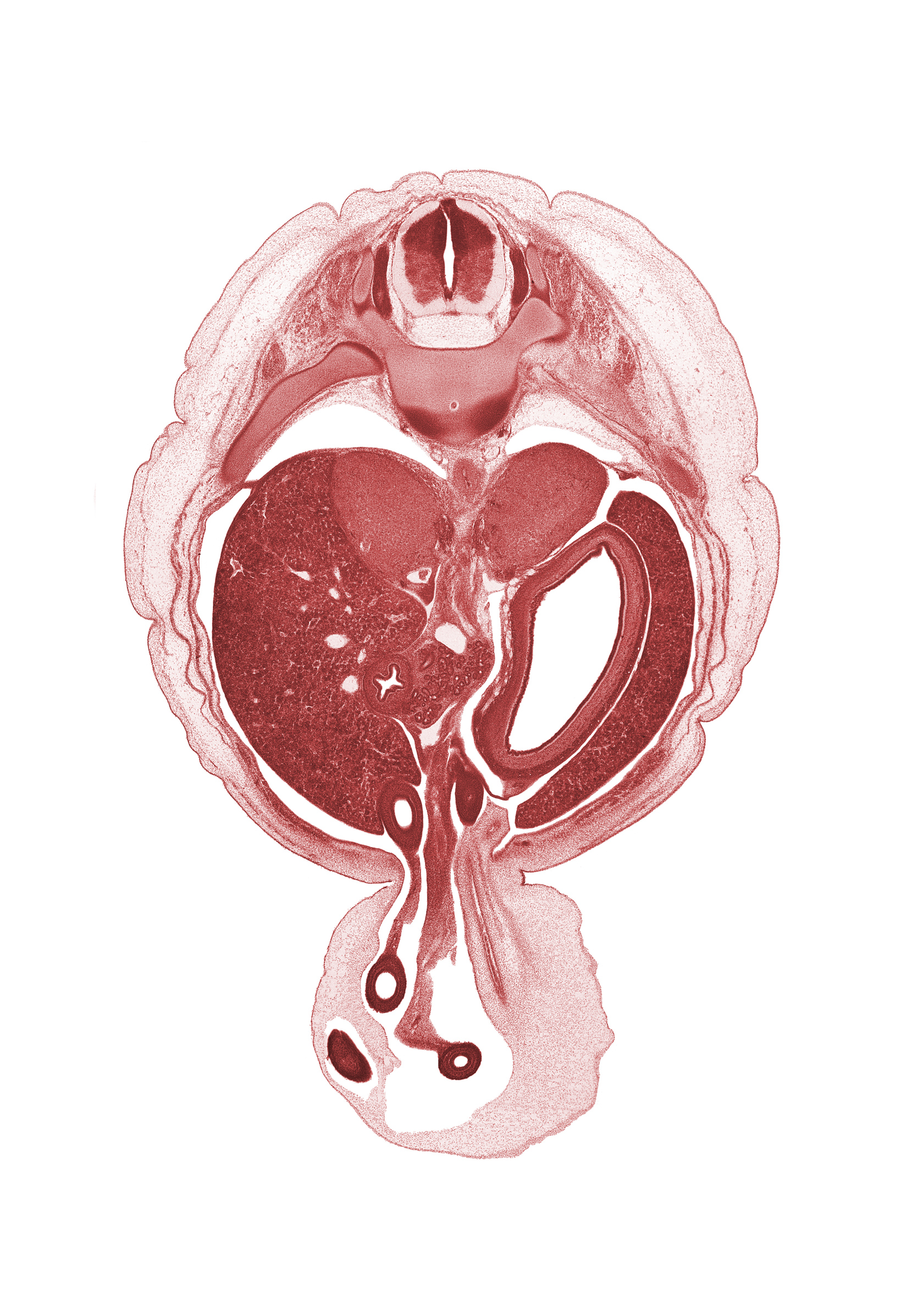 T-11 spinal ganglion, allantois, aorta, caudal edge of pleural cavity, cephalic edge of mesonephros, distal part of duodenum, duodenum (second part), greater curvature of stomach, hepatic portal vein, iliocostalis muscle, left lobe of liver, left umbilical artery, longissimus muscle, neural arch, peritoneal cavity, proximal limb of herniated midgut, right umbilical artery, spinalis muscle, superior mesenteric vessels, suprarenal gland cortex