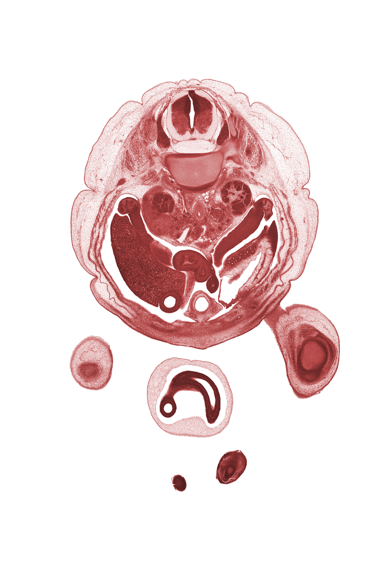 T-12 spinal ganglion, aorta, body of dorsal pancreas, duodenum, dura mater, hindgut, left kidney (metanephros), mesonephros, ovary, right lobe of liver, spleen, subarachnoid space, superior pole of right kidney (metanephros), toe of left foot, umbilical coelom