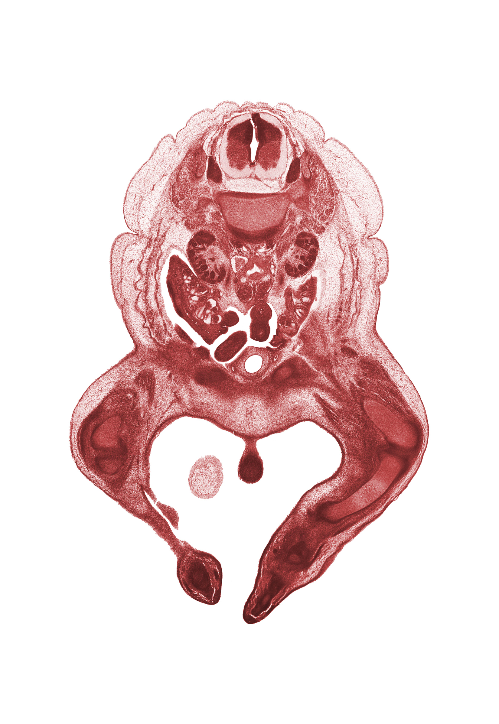 L-1 spinal ganglion, adductor longus muscle, aortic bifurcation, artifact fracture(s), caudal edge of ovary, caudal edge of right lobe of liver, caudal edge of umbilical cord, cephalic edge of clitoris, degenerating mesonephros, dorsum of foot, duodenum, femur, hilum of kidney (metanephros), kidney (metanephros), knee joint, paramesonephric duct, pubis, symphysis of pubis, tibia