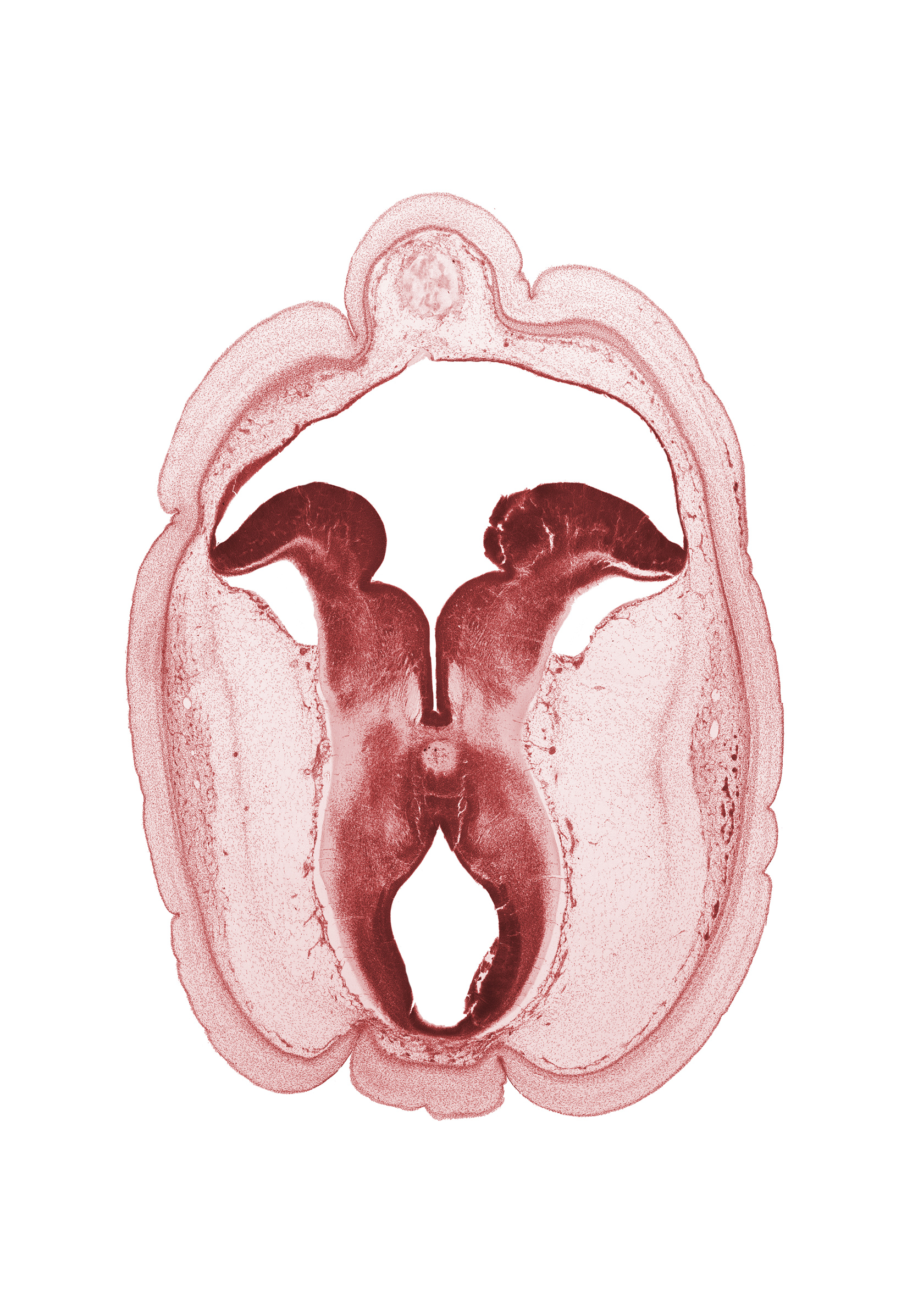 alar plate of metencephalon (cerebellum), artifact fracture(s), artifact space(s), basal plate, cerebral peduncle, edge of diverticulum of rhombencoel (fourth ventricle), interpeduncular fossa, osteogenic layer, rhombencoel (fourth ventricle), roof plate, subarachnoid space, sulcus limitans, surface ectoderm, trochlear nerve (CN IV), vascular plexus