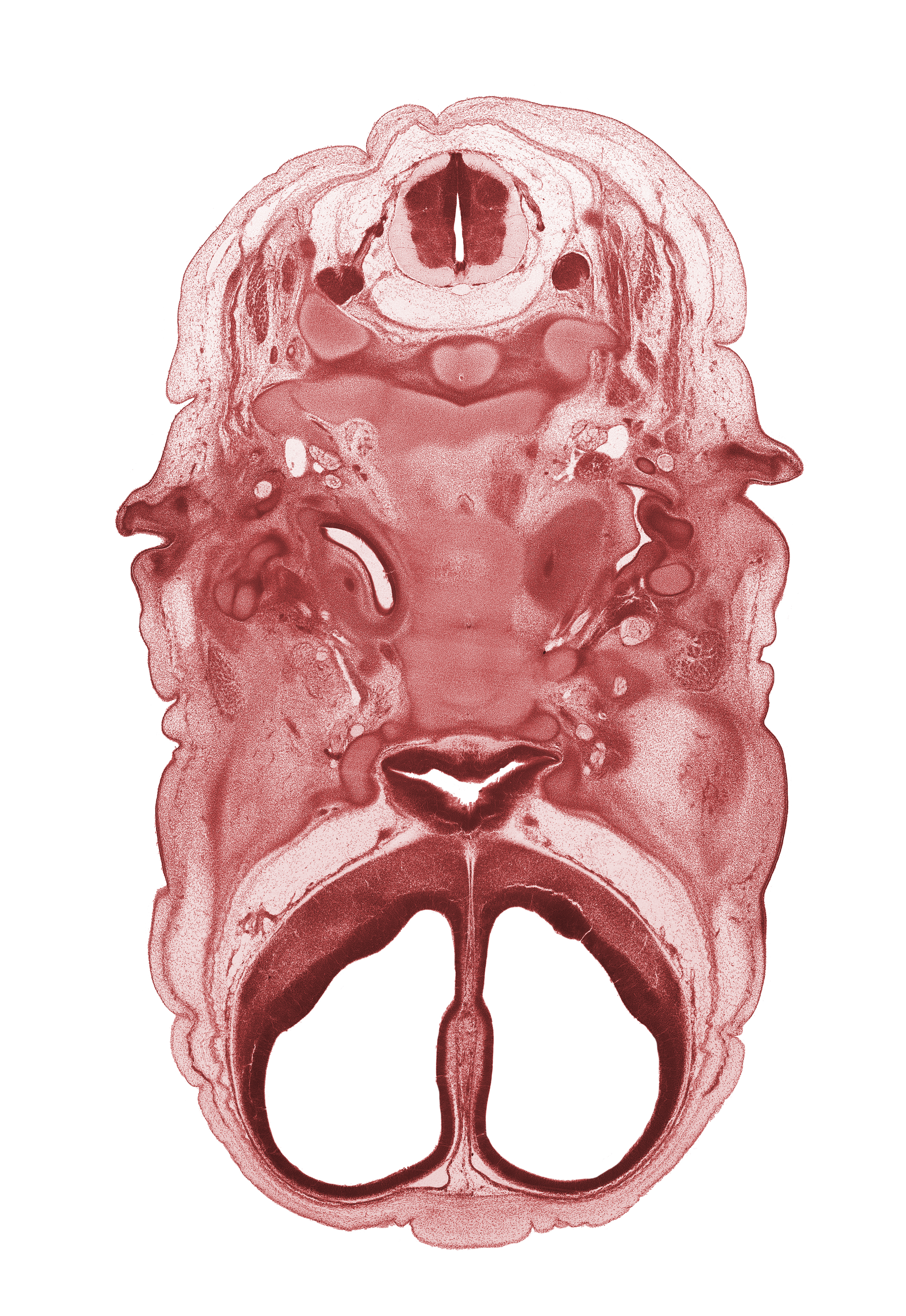 C-2 spinal ganglion, C-2 spinal nerve, alisphenoid, anterior cerebral artery, auricle, body of sphenoid, dens of C-2 vertebra (axis), edge of eyeball, facial nerve (CN VII), frontalis muscle, internal carotid artery, notochord, optic groove, orbitosphenoid, osteogenic layer, pharyngotympanic tube, pre-optic area, spinal accessory nerve (CN XI), subarachnoid space, vagus nerve (CN X), ventral arch of C-1 vertebra (atlas)