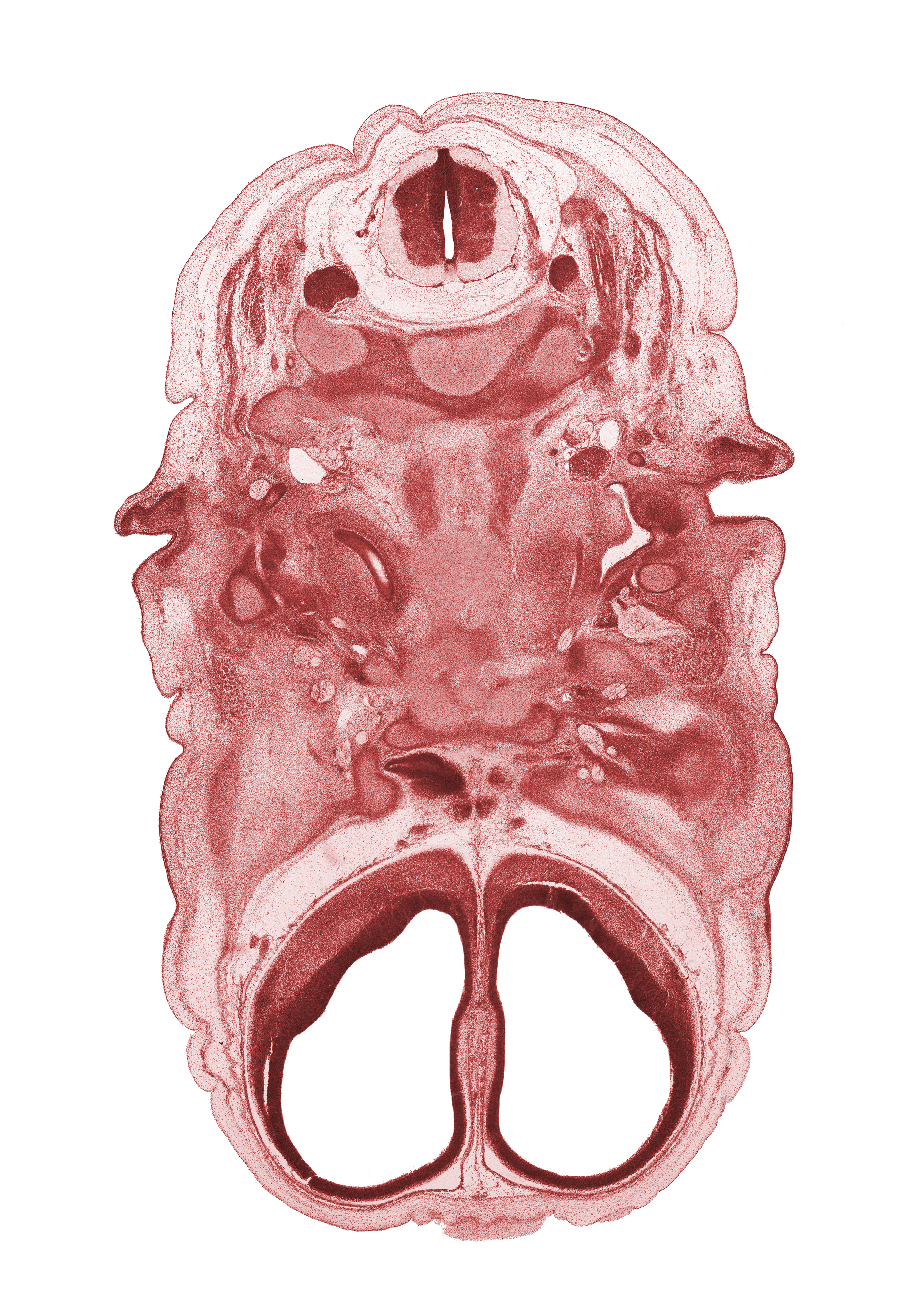 C-2 spinal ganglion, C-2 spinal nerve, artifact fracture(s), artifact separation(s), auricle, body of sphenoid, cephalic edge of diencephalon, falx cerebri region, inferior ganglion of glossopharyngeal nerve (CN IX), longus capitis muscle, mandibular nerve (CN V₃), maxillary nerve (CN V₂), ophthalmic nerve (CN V₁), optic nerve (CN II), pharyngeal arch 1 cartilage (Meckel), sympathetic trunk, venous plexus(es)