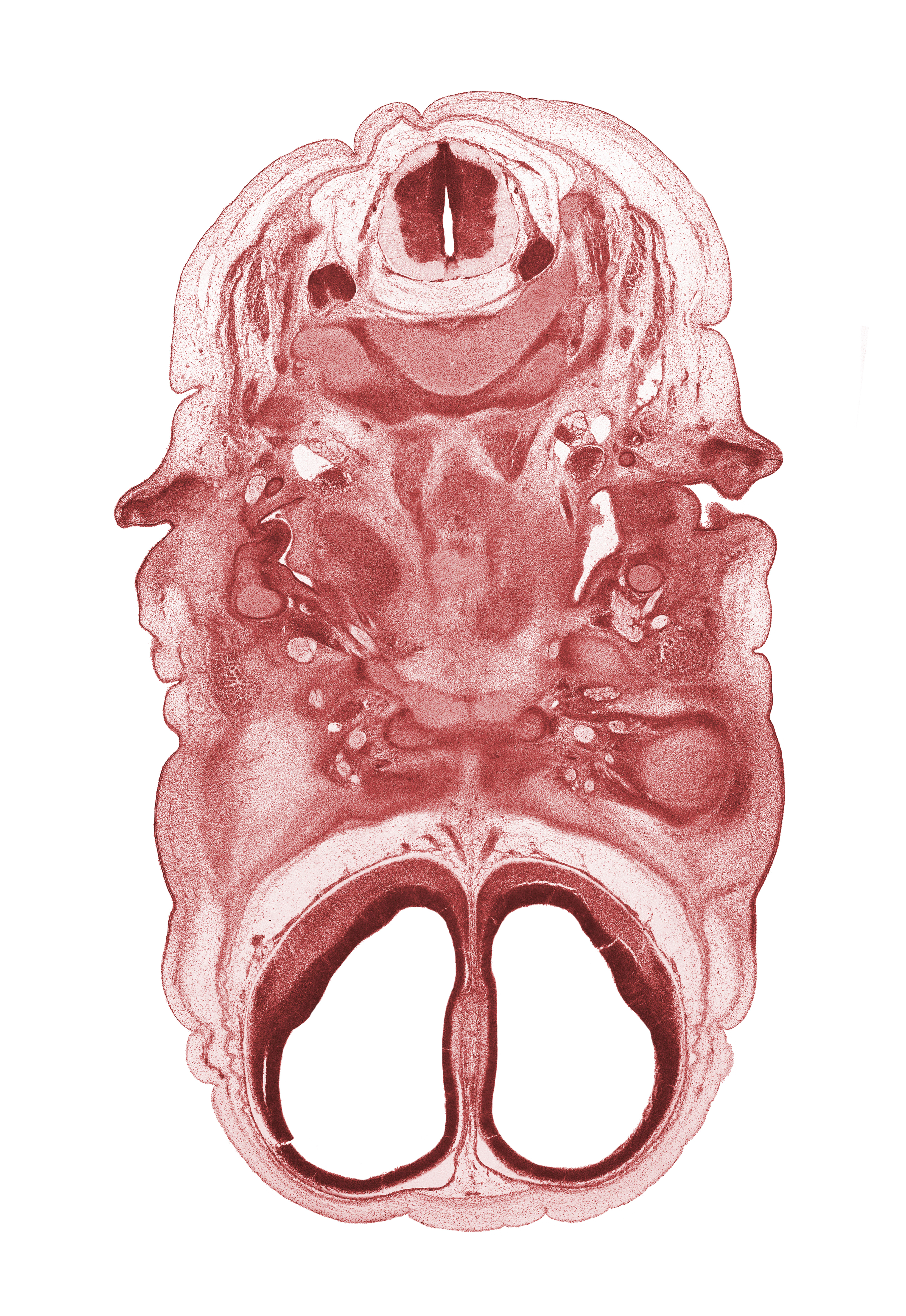 C-2 vertebra (axis), C-3 spinal ganglion, anterior cerebral artery, body of sphenoid, cerebral vesicle (hemisphere), external acoustic meatus, extrinsic ocular muscle(s), facial nerve (CN VII), inferior ganglion of glossopharyngeal nerve (CN IX), inferior ganglion of vagus nerve (CN X), internal carotid artery, lateral ventricle, osteogenic layer, pharyngeal arch 1 cartilage (Meckel), pharyngotympanic tube, stem of adenohypophysis, subarachnoid space