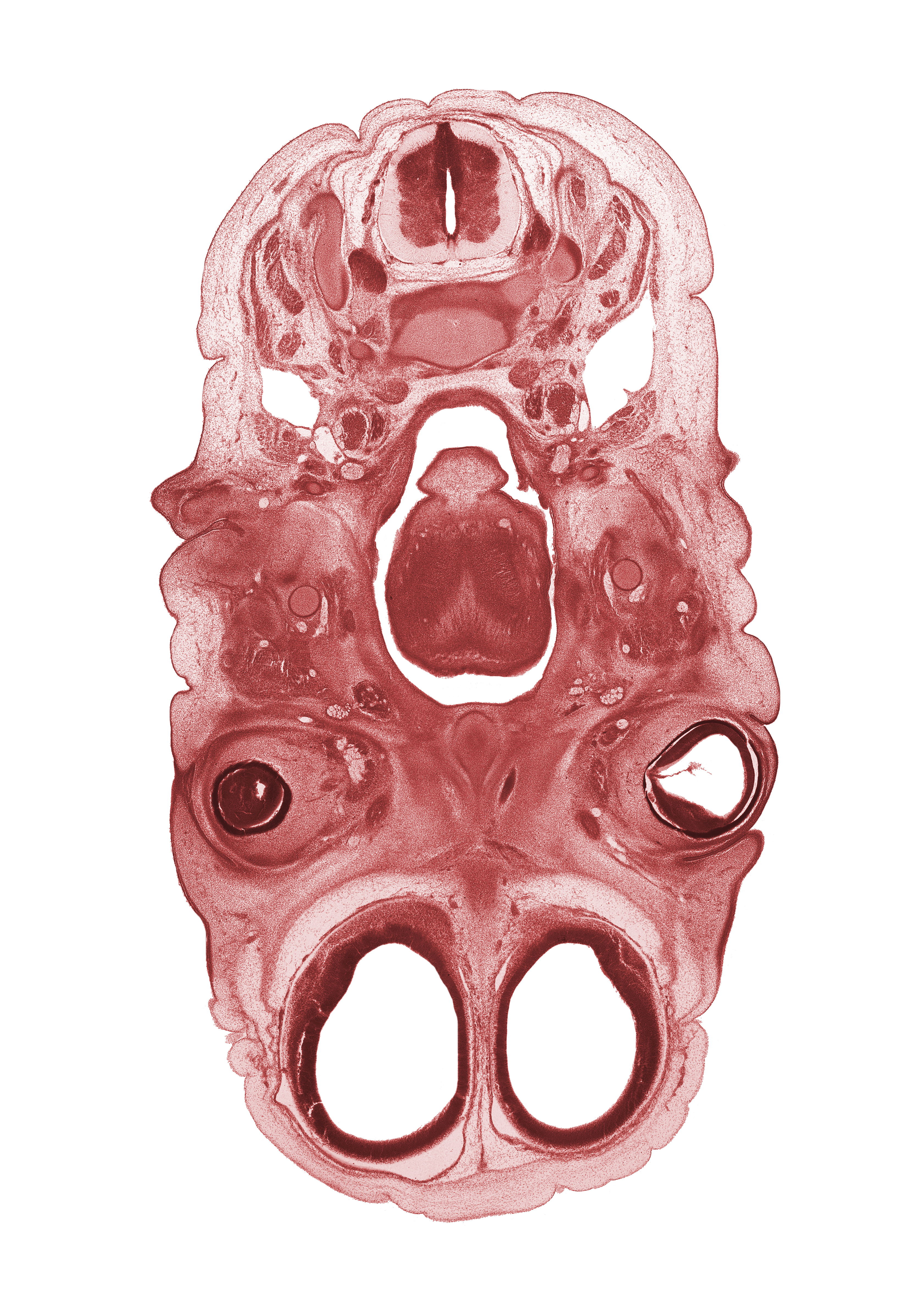 C-3 spinal ganglion, cerebral vesicle (hemisphere), cornea, edge of nasal ectoderm, epiglottis, ethmoid, lateral ventricle, lower eyelid, neural arch of C-3 vertebra, neural layer of retina, pharyngeal arch 1 cartilage (Meckel), pharyngeal arch 2 cartilage, pigmented layer of retina, ramus of mandible, semispinalis capitis muscle, splenius muscle, sternocleidomastoid muscle, subarachnoid space, tongue, trapezius muscle, upper eyelid