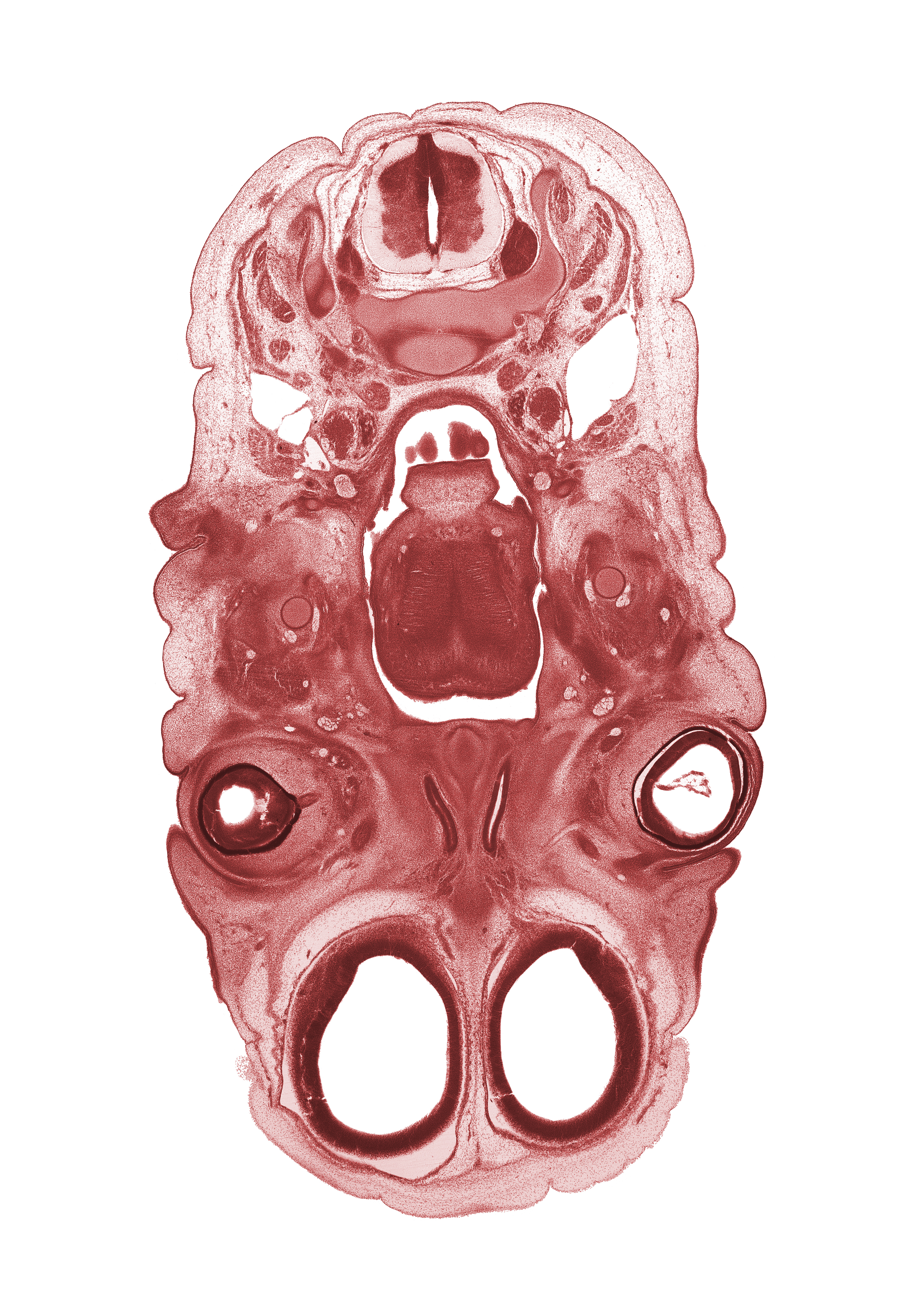 C-3 spinal ganglion, anterior cerebral artery, cephalic edge of arytenoid swelling, cervical plexus, crista galli, extrinsic ocular muscle(s), frontalis muscle, glossopharyngeal nerve (CN IX), intraretinal space (optic vesicle cavity), jugular lymph sac, laryngeal pharynx, lateral ventricle, lingual nerve, nasal cavity (nasal sac), neural arch of C-3 vertebra, olfactory filia (CN I), optic nerve (CN II), oronasal cavity, pharyngeal arch 1 cartilage (Meckel), sternocleidomastoid muscle