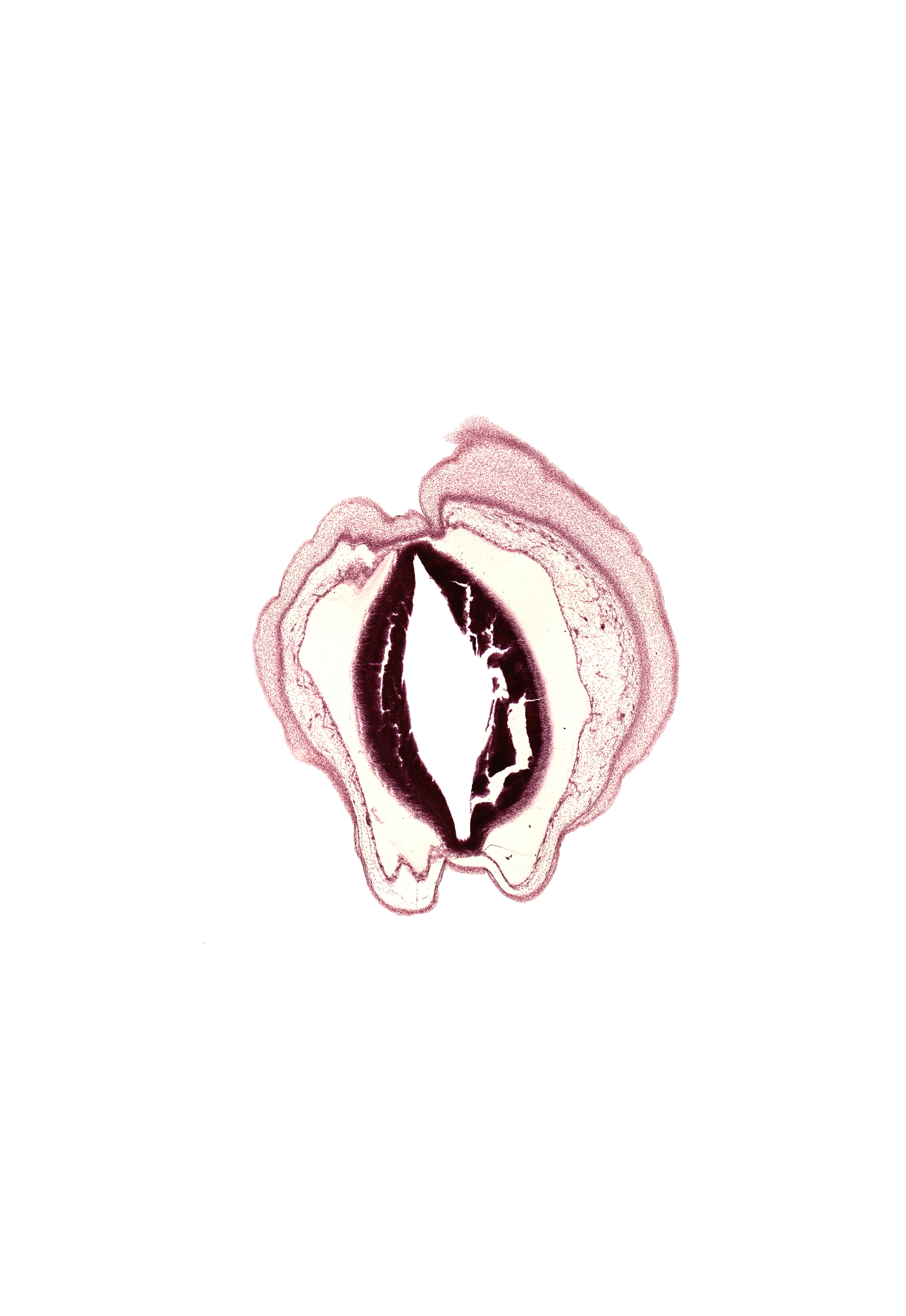 alar plate of mesencephalon, artifact fracture(s), artifact space(s), cerebral aqueduct (mesocoele), head mesenchyme, osteogenic layer, subarachnoid space, surface ectoderm