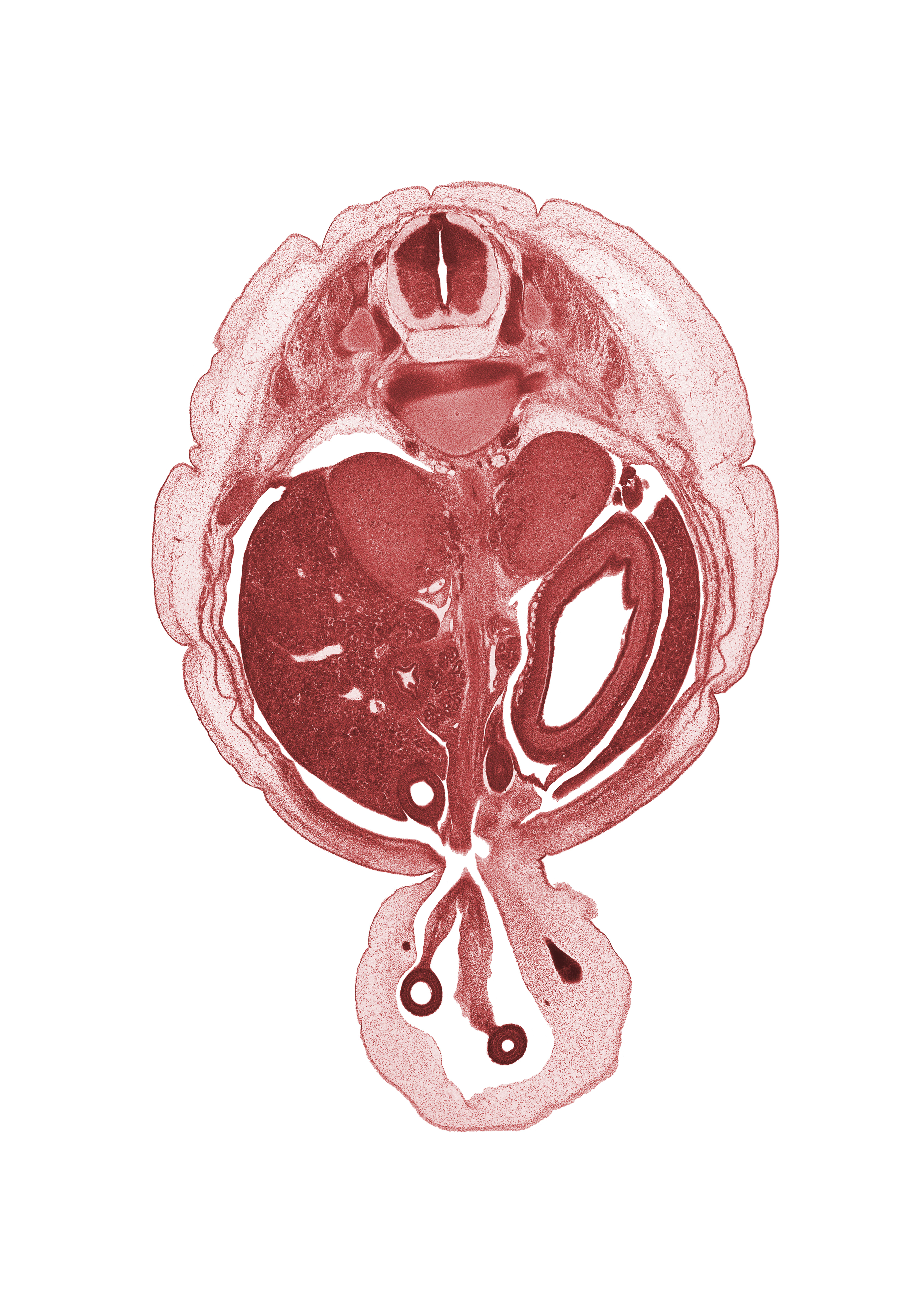 T-11 / T-12 intervertebral disc, T-11 spinal ganglion, T-11 spinal nerve, aorta, cephalic edge of ovary, duodenum (second part), head of ventral pancreas, junction of hindgut and midgut, left lobe of liver, mesonephros, proximal limb of herniated midgut, right lobe of liver, superior mesenteric artery, suprarenal gland cortex, sympathetic trunk, umbilical coelom