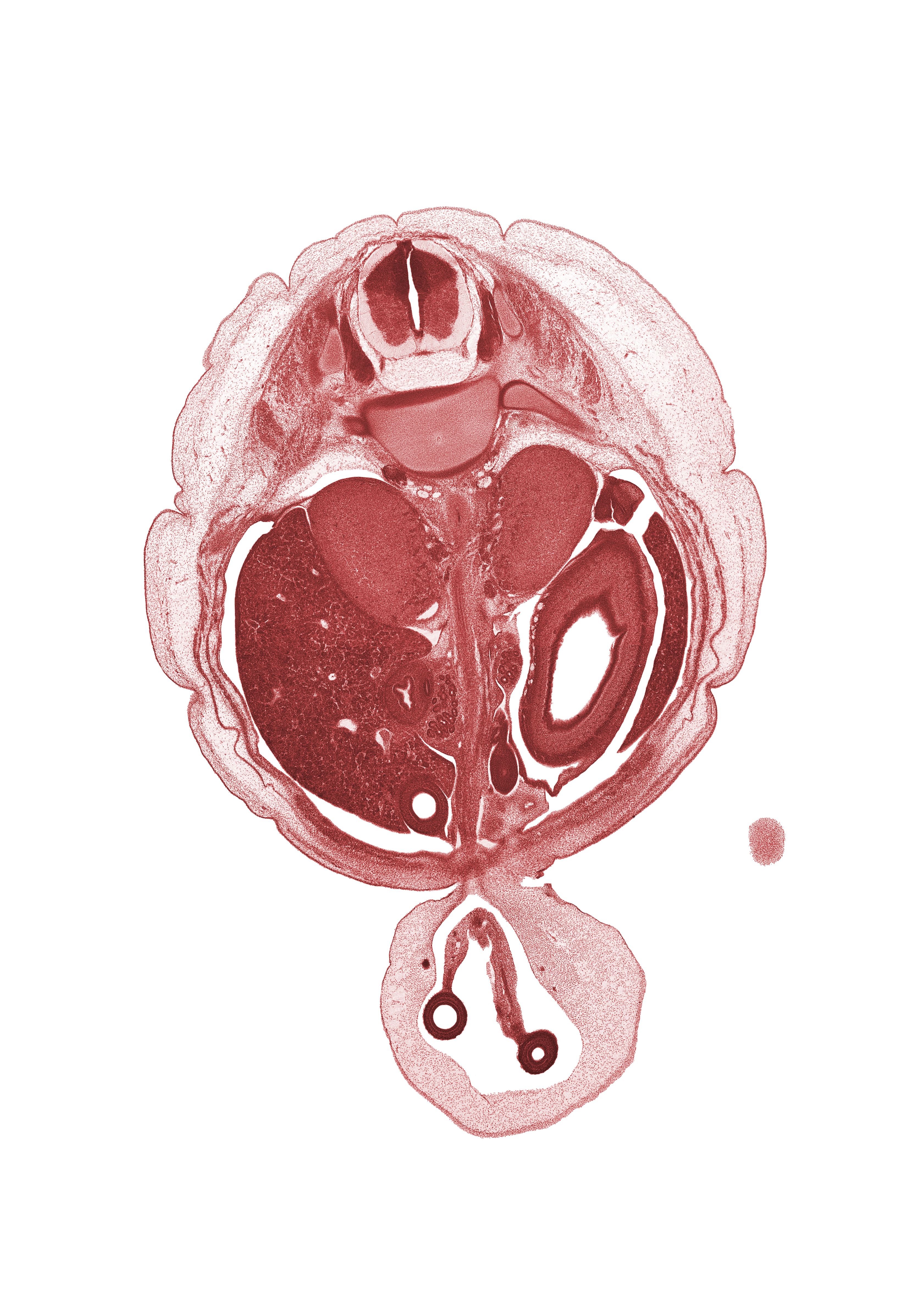 T-11 spinal ganglion, allantois, aorta, centrum of T-12 vertebra, cephalic edge of lower limb, duodenum, dura mater, grey matter, hindgut, left lobe of liver, left umbilical artery, mesentery, ovary, peritoneal cavity, proximal limb of herniated midgut, rib 12, right lobe of liver, right umbilical artery, subarachnoid space, superior mesenteric artery, umbilical coelom, white matter