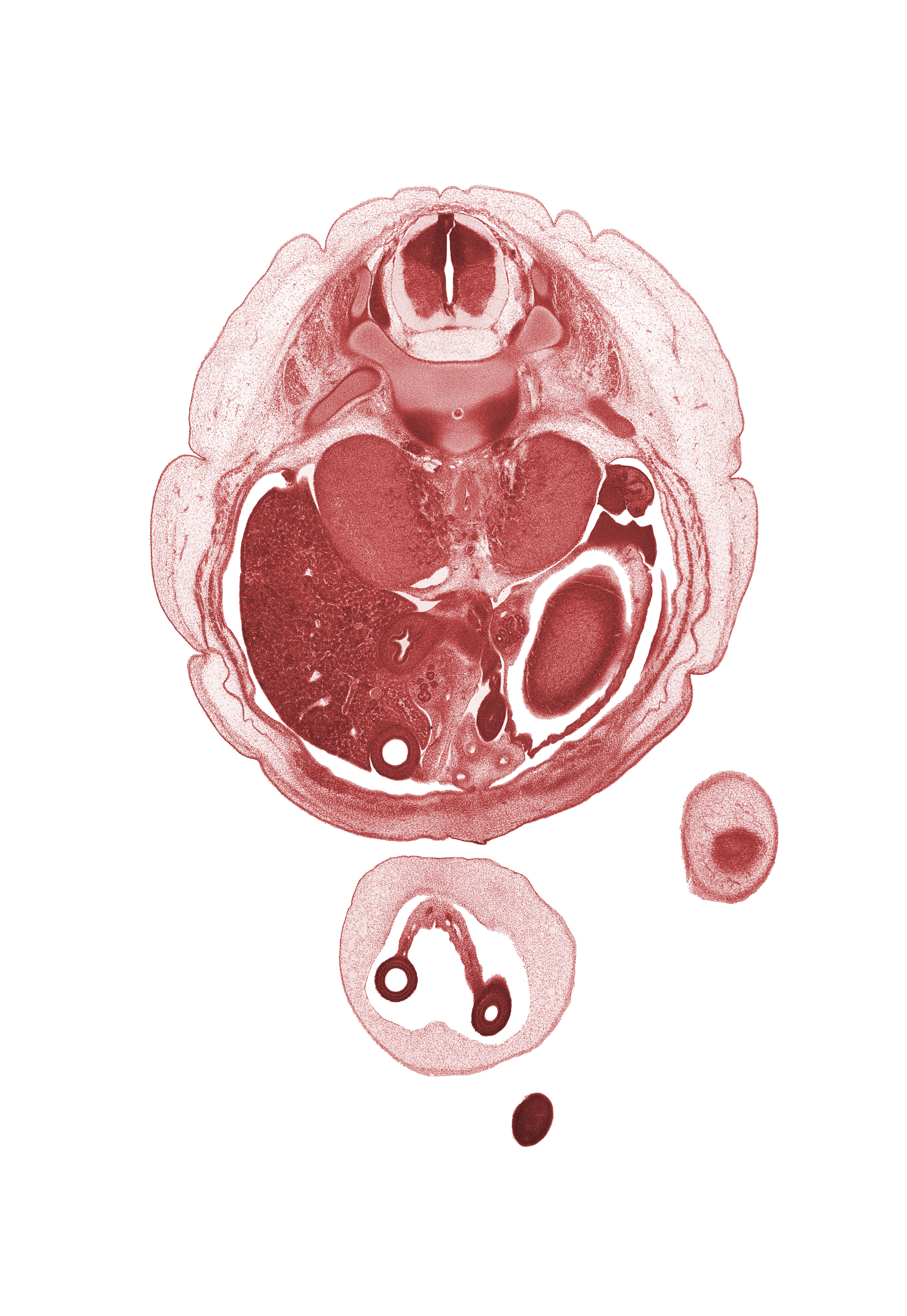 T-11 / T-12 interganglion region, T-12 / L-1 intervertebral disc, aorta, duodenum, junction of allantois and apex of urinary bladder, medial condyle of femur, mesonephros, muscularis of stomach, notochord, proximal limb of herniated midgut, right lobe of liver, spleen, subcostal nerve (T-12), suprarenal gland medulla, toe of left foot, umbilical coelom, umbilical cord