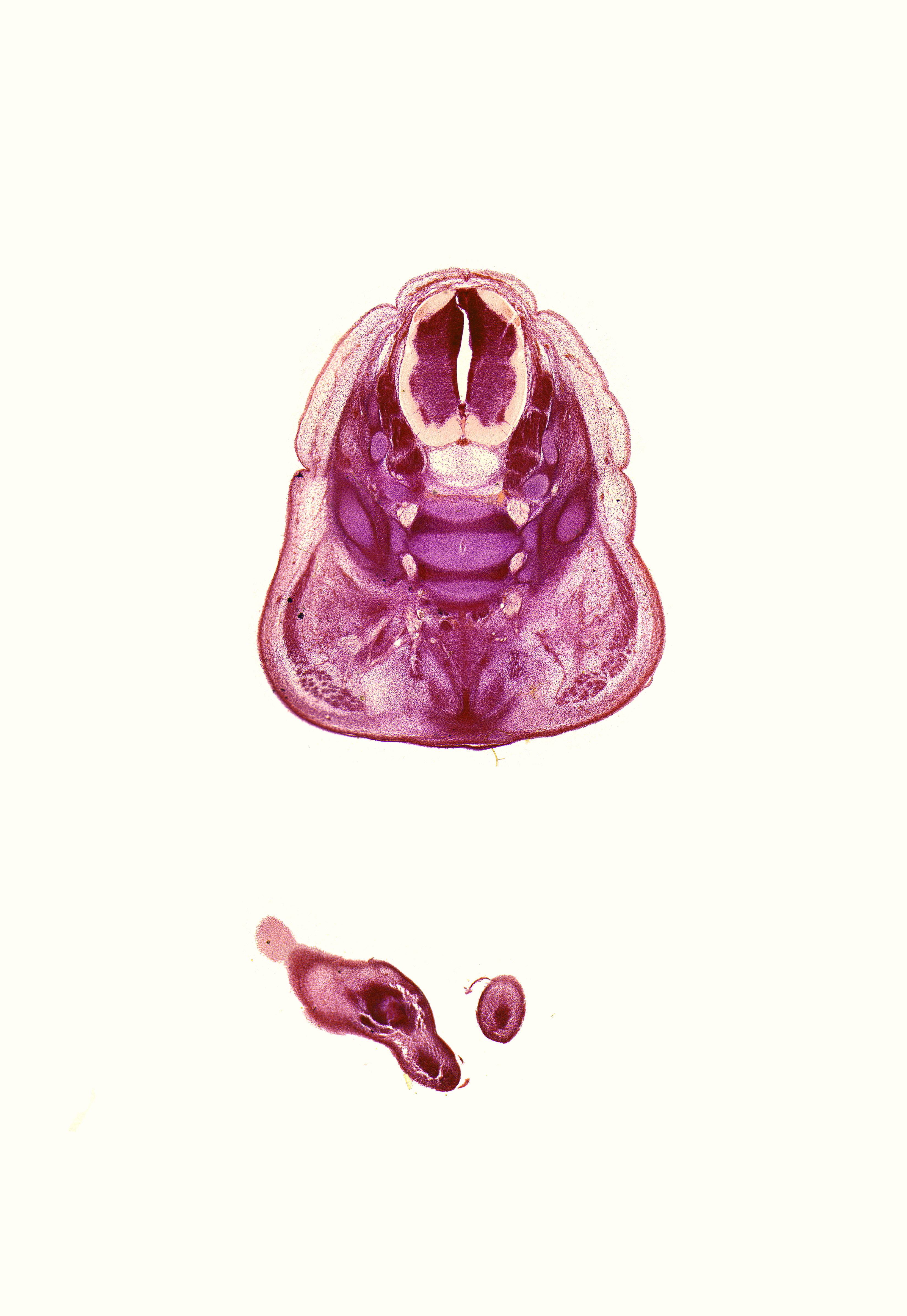 L-4 spinal ganglion, L-5 spinal ganglion, L-5 spinal nerve, S-1 / S-2 intervertebral region, S-1 ventral primary ramus, caudal eminence, dorsal fasciculus, gluteus maximus muscle, left foot, levator ani muscle, right foot, subarachnoid space, sympathetic trunk