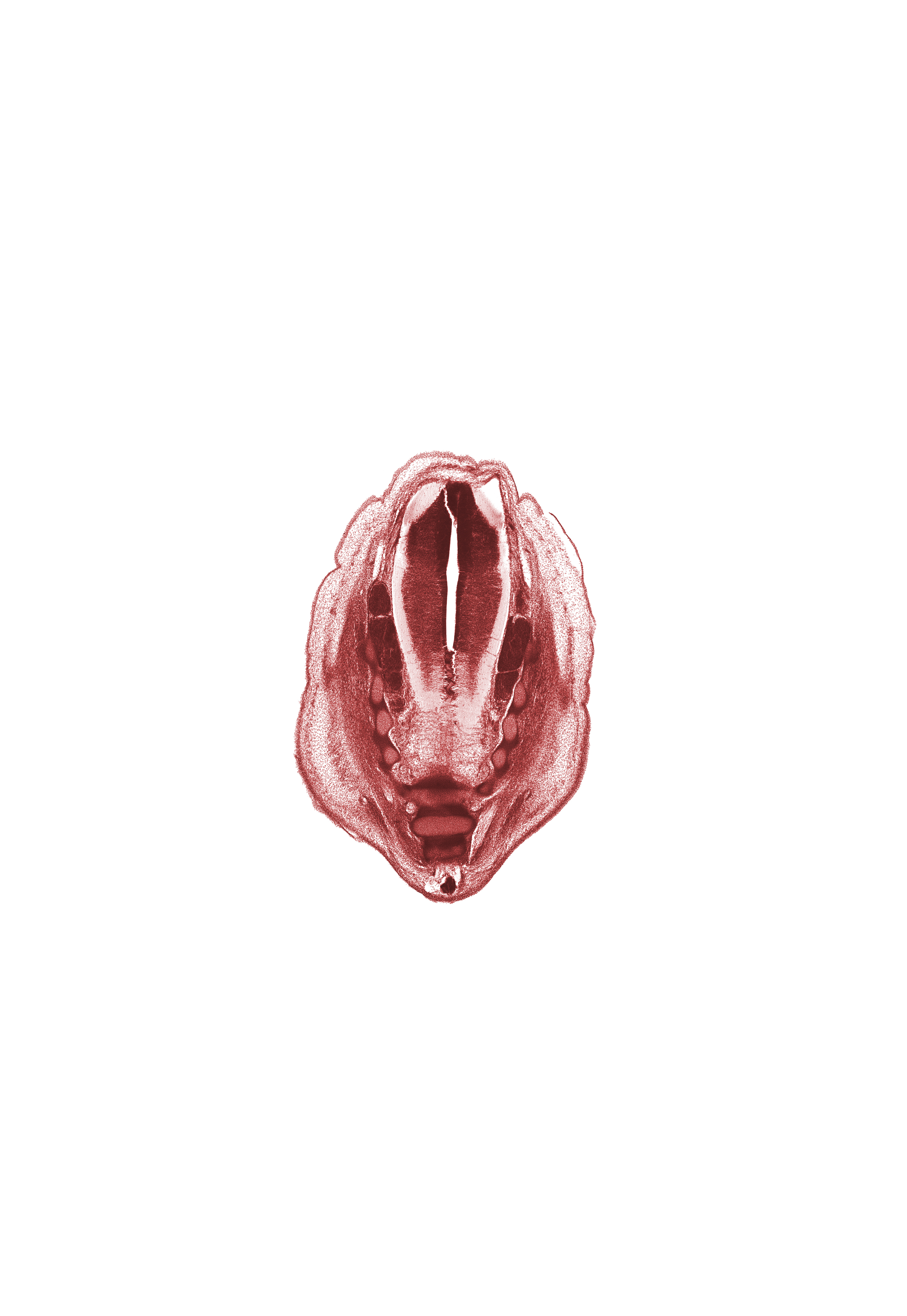 L-5 spinal ganglion, S-1 spinal ganglion, S-2 spinal ganglion, S-5 spinal nerve, caudal eminence, central canal, coccyx, dorsal fasciculus, filum terminale, neural arch of S-3 vertebra, neural arch of S-5 vertebra, osteogenic layer, subarachnoid space