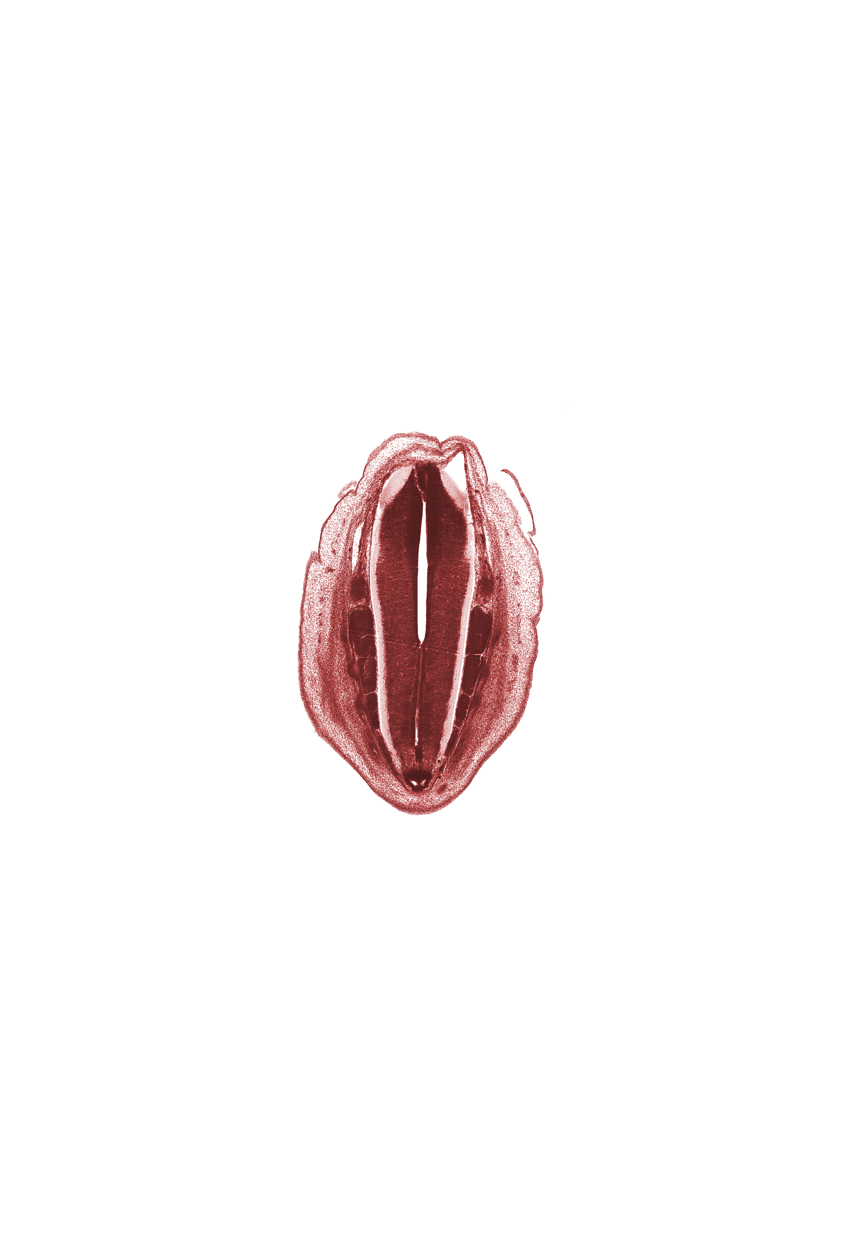 Co-1 spinal ganglion, S-1 spinal ganglion, S-2 spinal ganglion, S-3 spinal ganglion, S-4 spinal ganglion, S-5 spinal ganglion, artifact separation(s), central canal, edge of central canal, filum terminale, osteogenic layer, surface ectoderm