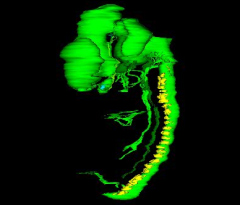 Nervous System