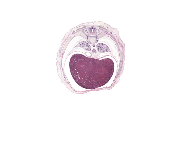 T-7 / T-8 interganglion region, anterior rectus sheath, artifact(s), azygos vein, central canal, esophageal nerve plexus, falciform ligament, inferior vena cava, innermost intercostal muscle(s), left lobe of liver, loose mesenchyme, muscular part of diaphragm, neural arch, peritoneal cavity, pleural recess, pulmonary ligament, rib 8, right lobe of liver, sympathetic trunk