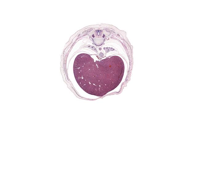 T-8 intercostal nerve, T-8 spinal ganglion, central canal, costal margin, inferior vena cava, latissimus dorsi muscle, left lobe of liver, liver prominence, loose mesenchyme, lower lobe of left lung, lower lobe of right lung, notochord, rectus abdominis muscle, rib 10, rib 9, right lobe of liver, surface ectoderm, trapezius muscle