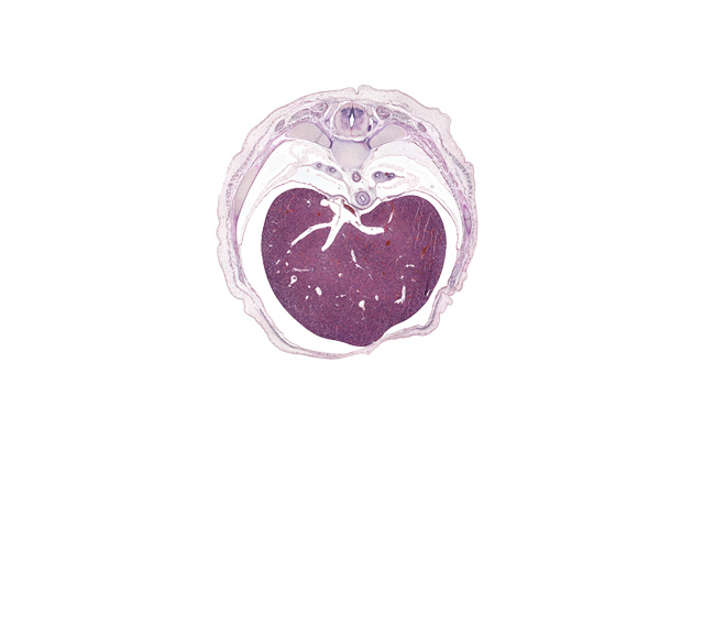 T-8 spinal ganglion, efferent hepatic vein, efferent hepatic veins, esophagus muscularis, head of rib 9, inferior vena cava, left lobe of liver, lower lobe of left lung, lower lobe of right lung, osteogenic layer, peritoneal cavity, pulmonary ligament, rib 10, rib 9, right lobe of liver, supra-umbilical part of abdominal wall