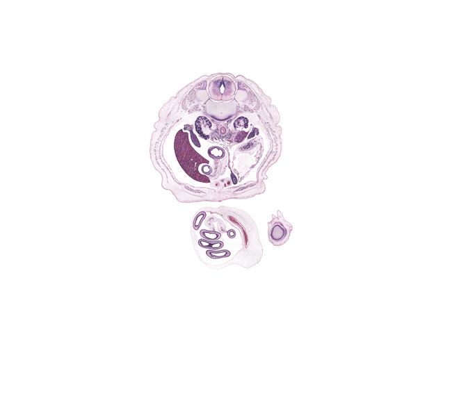 L-1 / L-2 intervertebral disc, T-12 / L-1 interganglion region, caudal edge of suprarenal gland cortex, centrum of L-1 vertebra, dorsal horn of grey matter, hindgut, junction of allantois and apex of urinary bladder, kidney (metanephros), lateral horn of grey matter, lesser sac (omental bursa), medial condyle of femur, mesentery, notochord, proximal limb of herniated midgut, rectus abdominis muscle, right lobe of liver, right umbilical artery, testis, umbilical coelom, ventral horn of grey matter