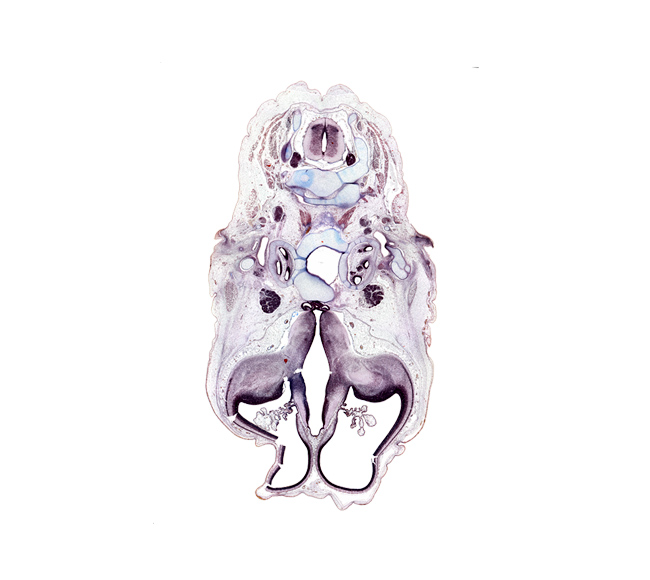 C-3 spinal ganglion, artifact(s), central canal, cochlear duct, dorsal median septum, dura mater, facial nerve (CN VII), glossopharyngeal nerve (CN IX), hypothalamic sulcus, hypothalamus, infundibular recess, insula area of neopallium, internal capsule, internal jugular vein, lateral ventricular eminence (telencephalon), mandibular nerve (CN V₃), neurohypophysis, otic ganglion, subthalamus, sulcus dorsalis, trigeminal ganglion (CN V), vagus nerve (CN X), vascular plexus, ventral median sulcus