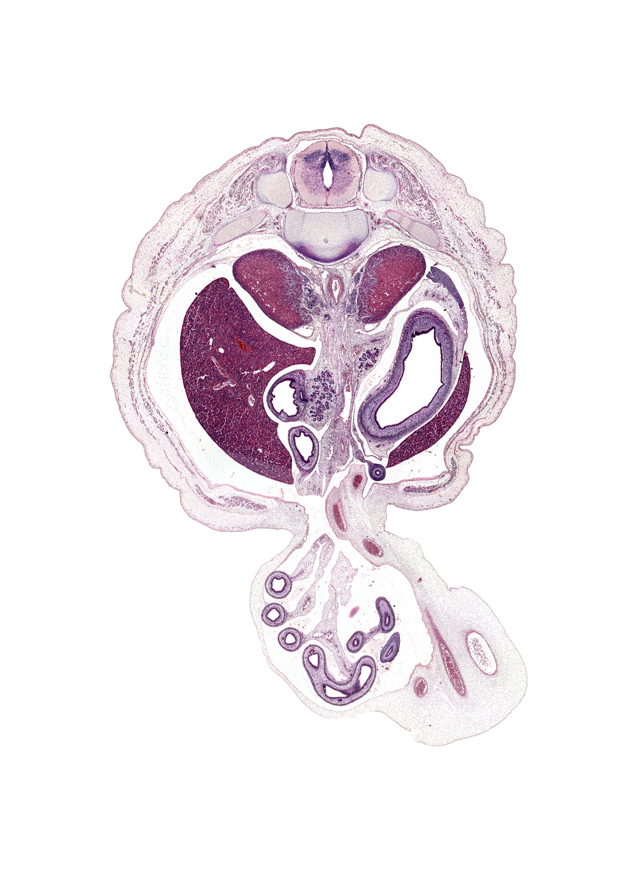 T-11 / T-12 interganglion region, T-12 / L-1 intervertebral disc, allantois, aorta, appendix, body of pancreas, body of stomach, celiac artery, distal limb of herniated midgut, distal part of duodenum, dorsal horn of grey matter, duodenum (second part), hindgut, junction of splenic and superior mesenteric veins, lateral horn of grey matter, left lobe of liver, left umbilical artery, lesser sac (omental bursa), notochord, proximal limb of herniated midgut, rib 12, right lobe of liver, right umbilical artery, spleen, superior mesenteric artery, superior mesenteric vein, tail of pancreas, umbilical coelom, umbilical vein, ventral horn of grey matter