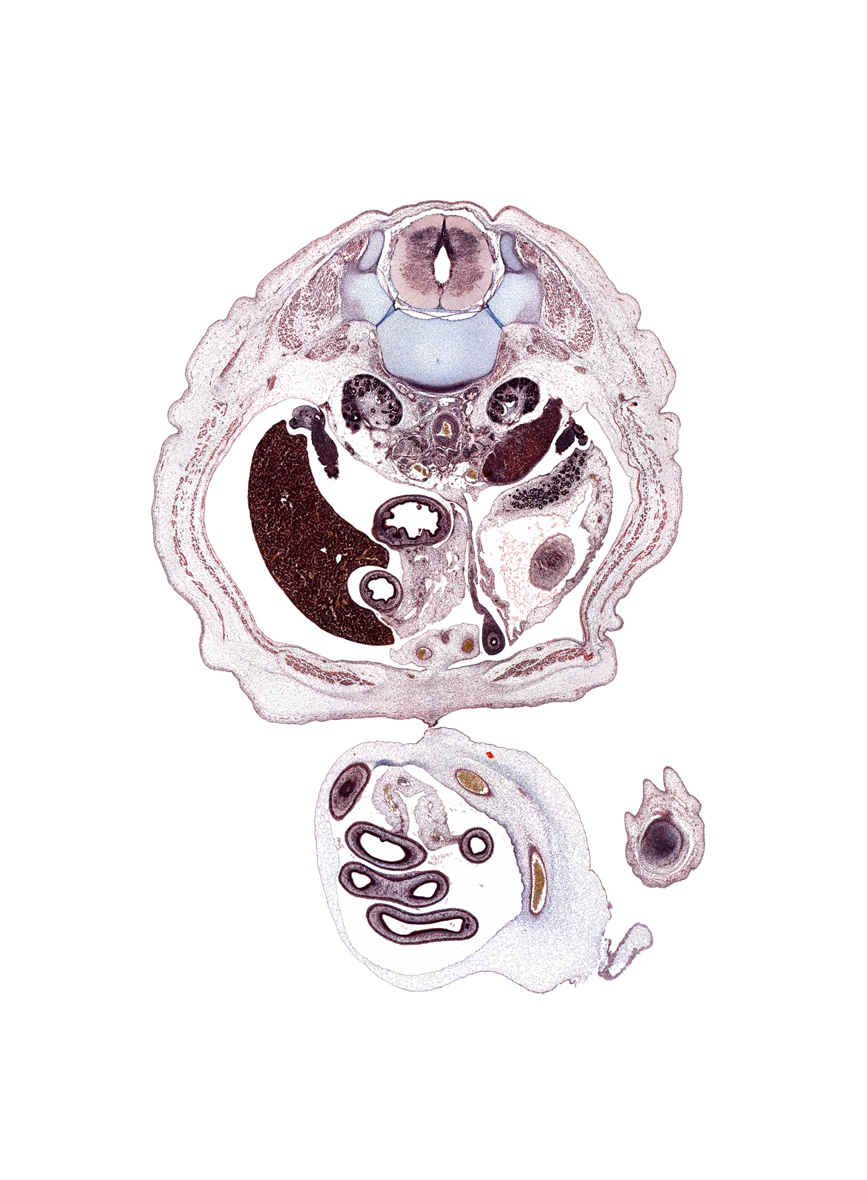 T-12 / L-1 interganglion region, anterior rectus sheath, caudal edge of stomach, cephalic edge of testis, external abdominal oblique muscle, hindgut, intermediate zone, internal abdominal oblique muscle, kidney (metanephros), lesser sac (omental bursa), marginal zone, medial condyle of femur, mesonephros, posterior rectus sheath, proximal limb of herniated midgut, rectus abdominis muscle, right umbilical artery, surface ectoderm, testis, transversus abdominis muscle, ventricular zone