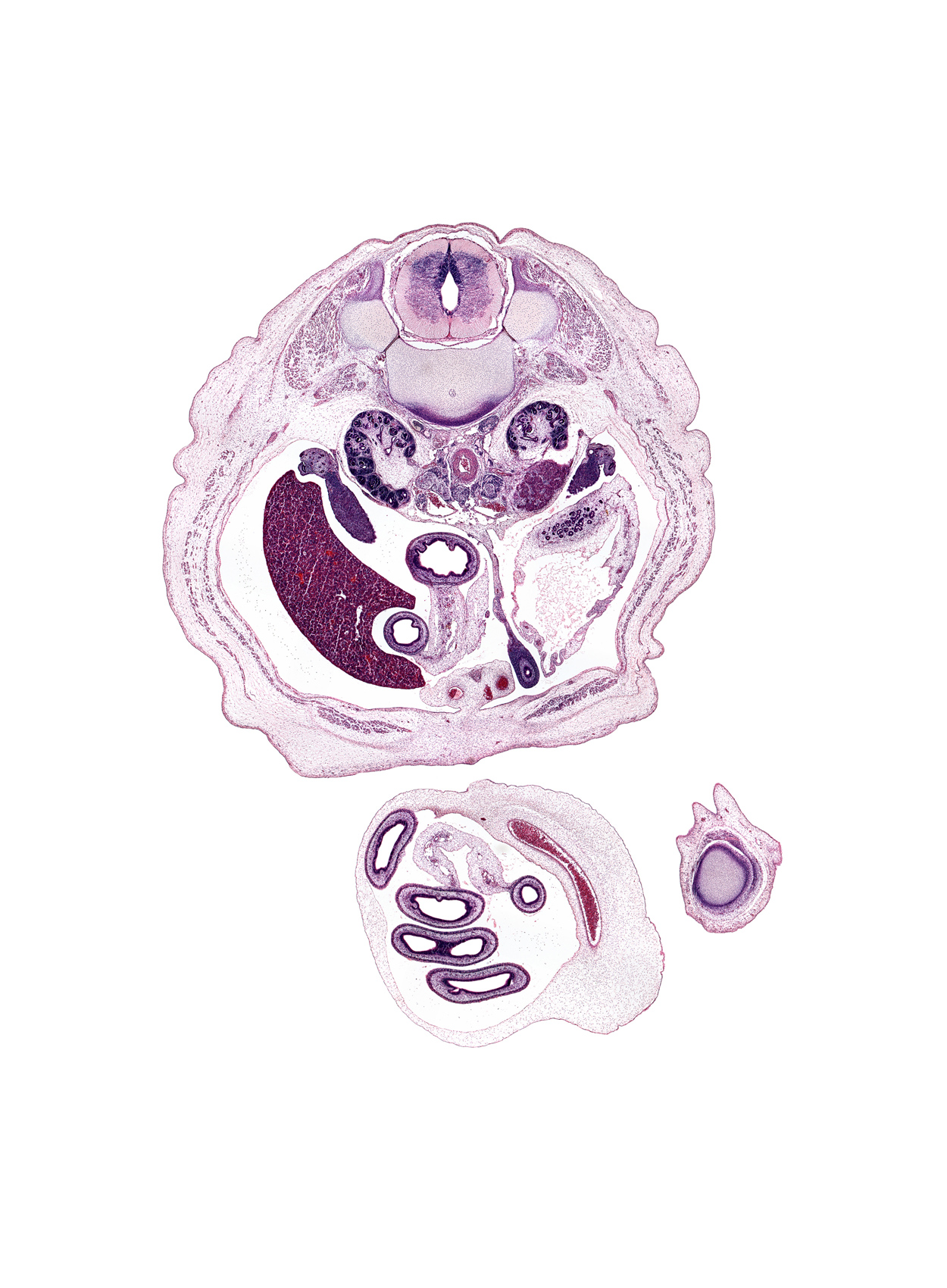 L-1 / L-2 intervertebral disc, T-12 / L-1 interganglion region, caudal edge of suprarenal gland cortex, centrum of L-1 vertebra, dorsal horn of grey matter, hindgut, junction of allantois and apex of urinary bladder, kidney (metanephros), lateral horn of grey matter, lesser sac (omental bursa), medial condyle of femur, mesentery, notochord, proximal limb of herniated midgut, rectus abdominis muscle, right lobe of liver, right umbilical artery, testis, umbilical coelom, ventral horn of grey matter