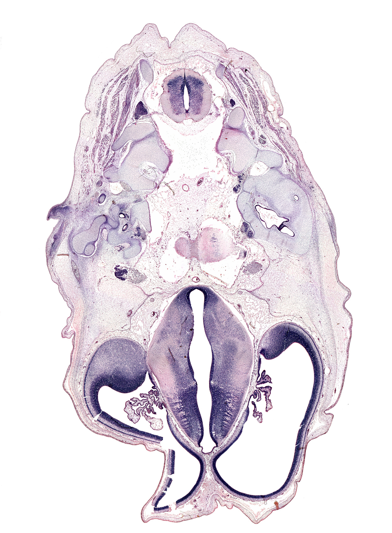 C-2 spinal ganglion, accessory nerve (CN XI), basi-occipital (basal plate), basilar artery, decussation, dorsal median septum, dorsal thalamus, edge of pons region (metencephalon), foramen magnum region, glossopharyngeal nerve (CN IX), hypoglossal nerve (CN XII), hypothalamic sulcus, hypothalamus, lateral mass of C-1 vertebra (atlas), lateral semicircular duct, marginal ridge, oculomotor nerve (CN III), posterior arch of C-2 vertebra (axis), posterior communicating artery, roof plate of diencephalon, root of trigeminal nerve (CN V), sulcus dorsalis, sulcus medius, trochlear nerve (CN IV), utricle, vagus nerve (CN X), ventral median sulcus, ventral thalamus, vertebral artery