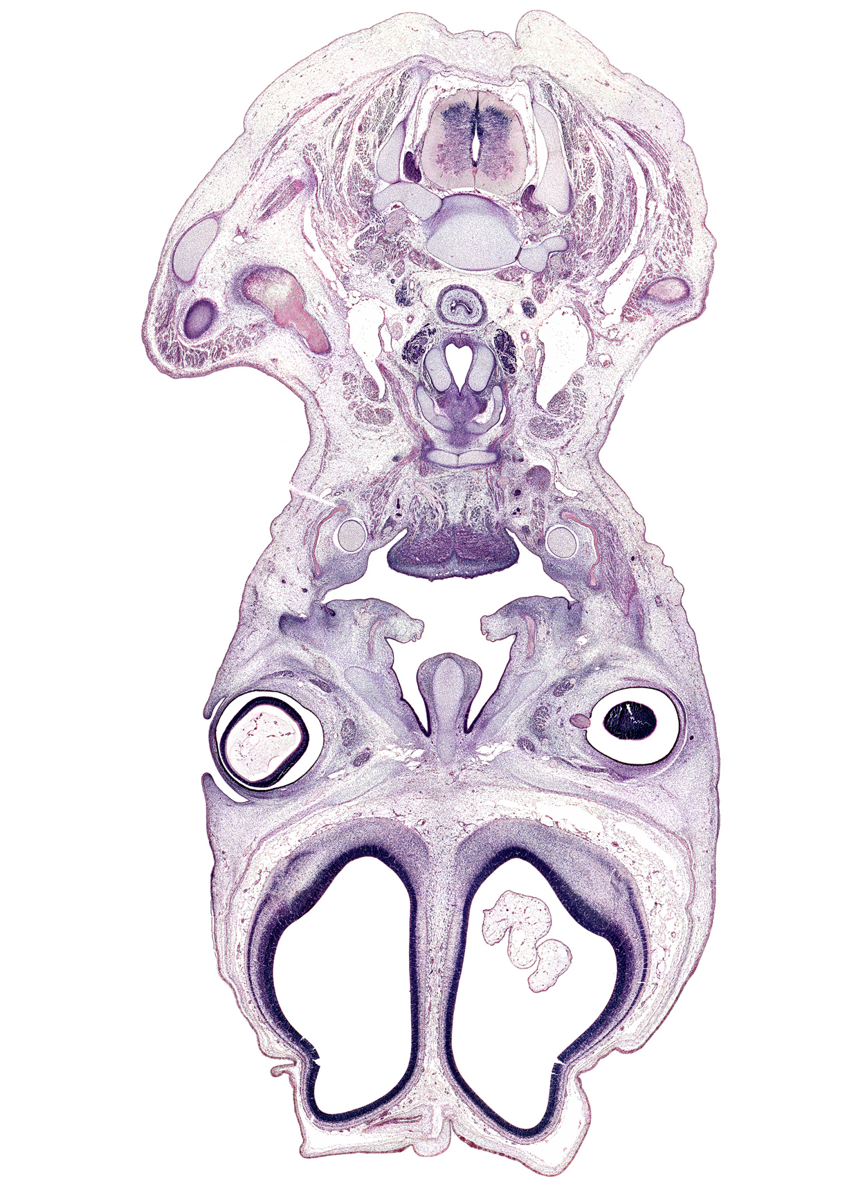 C-5 / C-6 intervertebral disc, C-6 spinal ganglion, C-6 spinal nerve, body of hyoid (pharyngeal arch 3 cartilage), cerebral vesicle (hemisphere), choroid plexus, common carotid artery, cortical plate, cricoid cartilage, dorsal horn of grey matter, extrinsic ocular muscle(s), grey matter, hypoglossal nerve (CN XII), hypoglossus muscle, internal jugular vein, mandible, masseter muscle, middle cervical sympathetic ganglion, nasal septal cartilage, optic nerve (CN II), sternocleidomastoid muscle, superior ophthalmic vein, thyroid cartilage, thyroid gland, tooth bud(s), transverse process, vagus nerve (CN X), ventral horn of grey matter, white matter